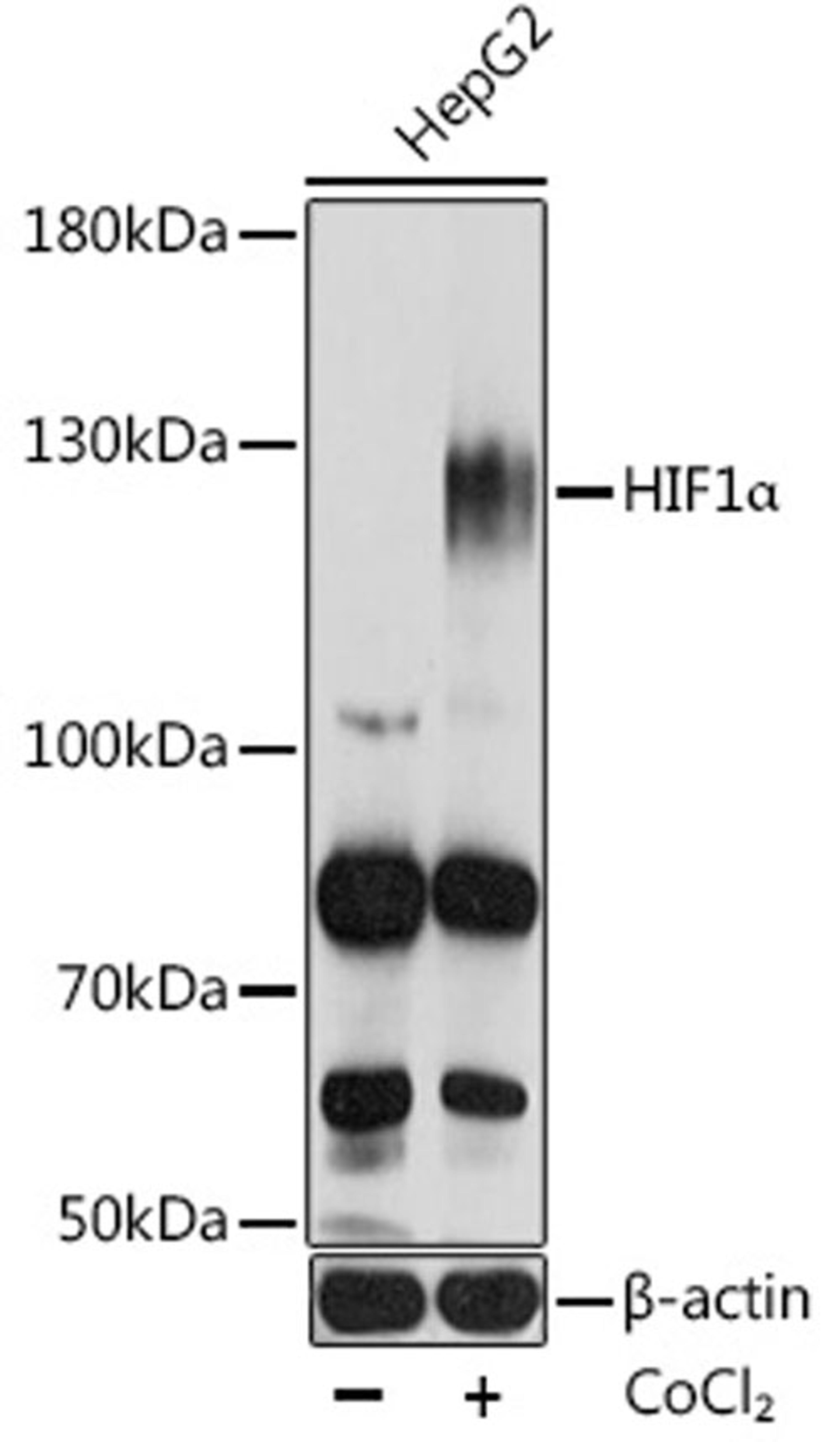 Western blot - HIF1a antibody (A7684)