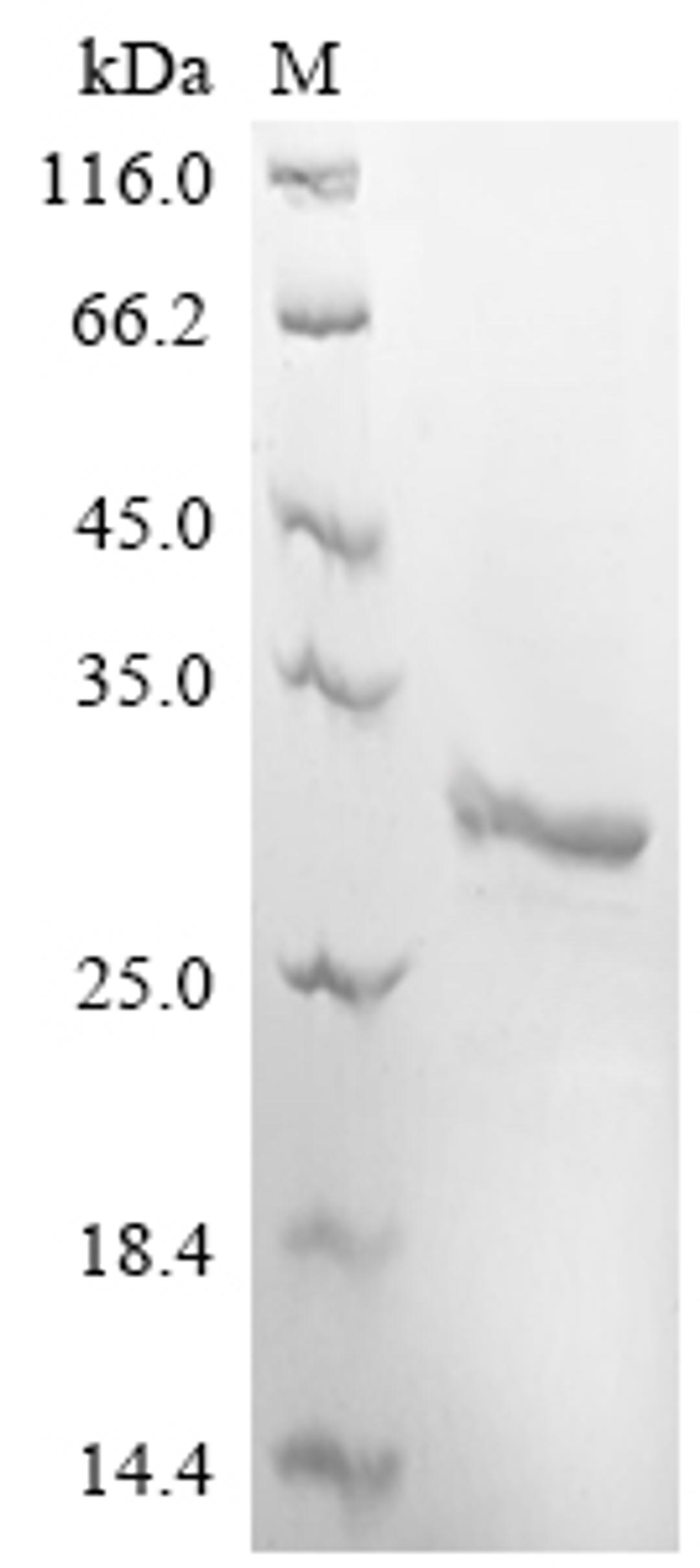 (Tris-Glycine gel) Discontinuous SDS-PAGE (reduced) with 5% enrichment gel and 15% separation gel.