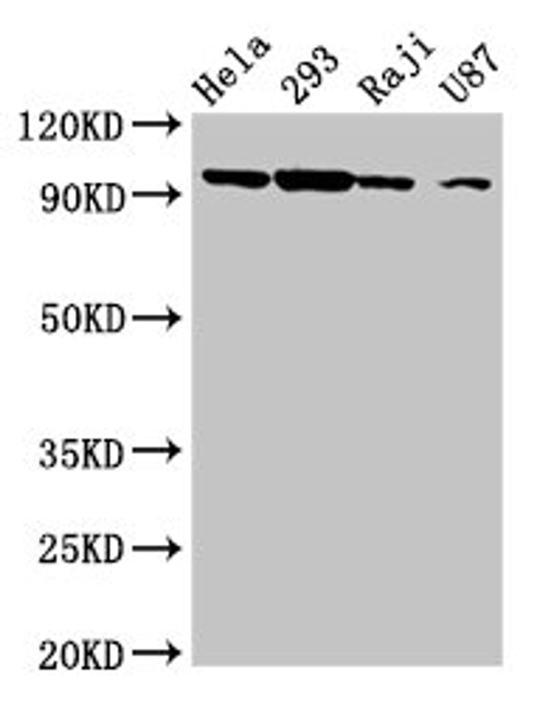 Western Blot. Positive WB detected in: Hela whole cell lysate, 293 whole cell lysate, Raji whole cell lysate, U87 whole cell lysate. All lanes: MASTL antibody at 6.3µg/ml. Secondary. Goat polyclonal to rabbit IgG at 1/50000 dilution. Predicted band size: 98, 93 kDa. Observed band size: 98 kDa