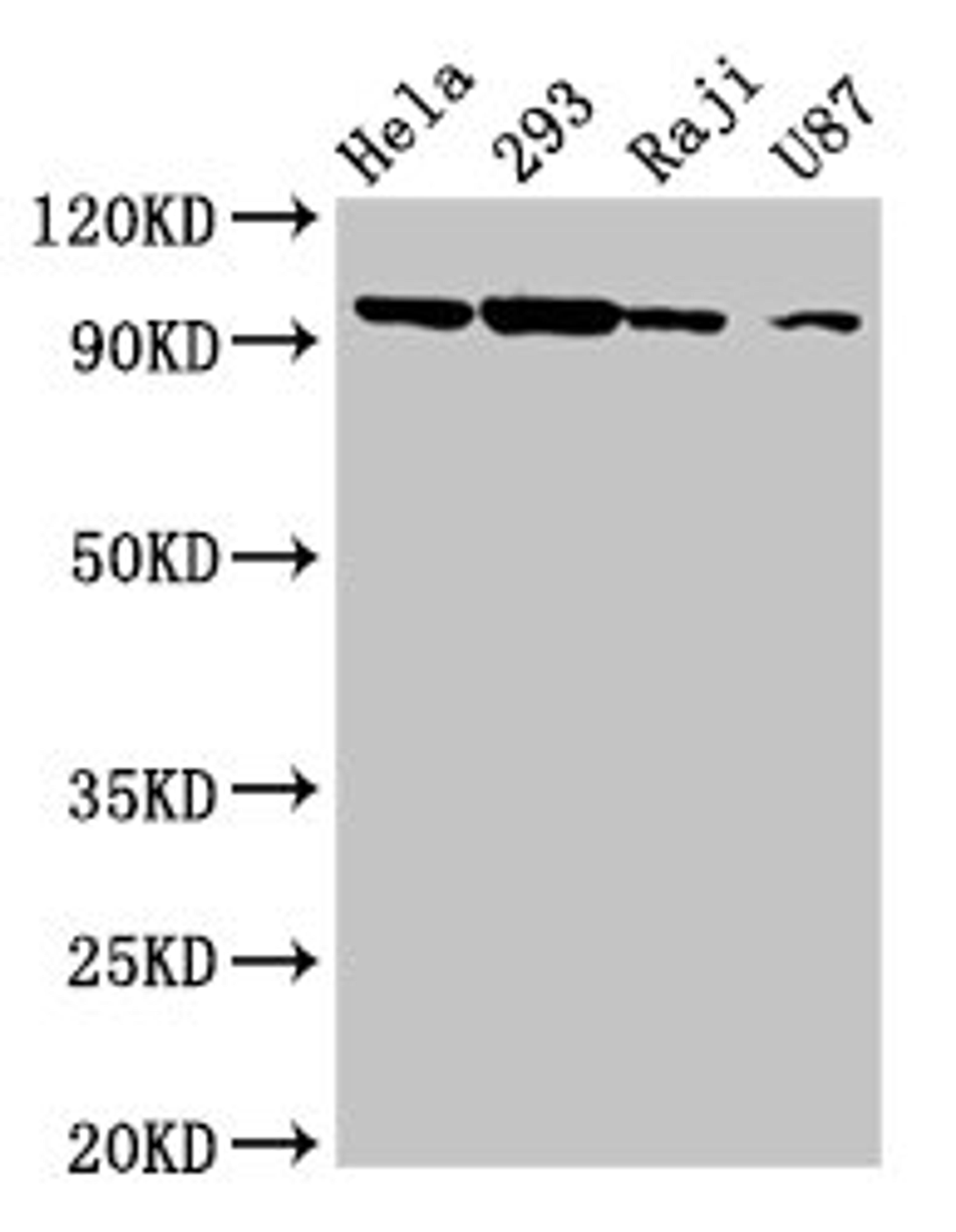 Western Blot. Positive WB detected in: Hela whole cell lysate, 293 whole cell lysate, Raji whole cell lysate, U87 whole cell lysate. All lanes: MASTL antibody at 6.3µg/ml. Secondary. Goat polyclonal to rabbit IgG at 1/50000 dilution. Predicted band size: 98, 93 kDa. Observed band size: 98 kDa