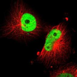 Immunocytochemistry/Immunofluorescence: SOX9 Antibody [NBP1-85551] - Staining of human cell line U-251 MG shows positivity in nucleus but not nucleoli.