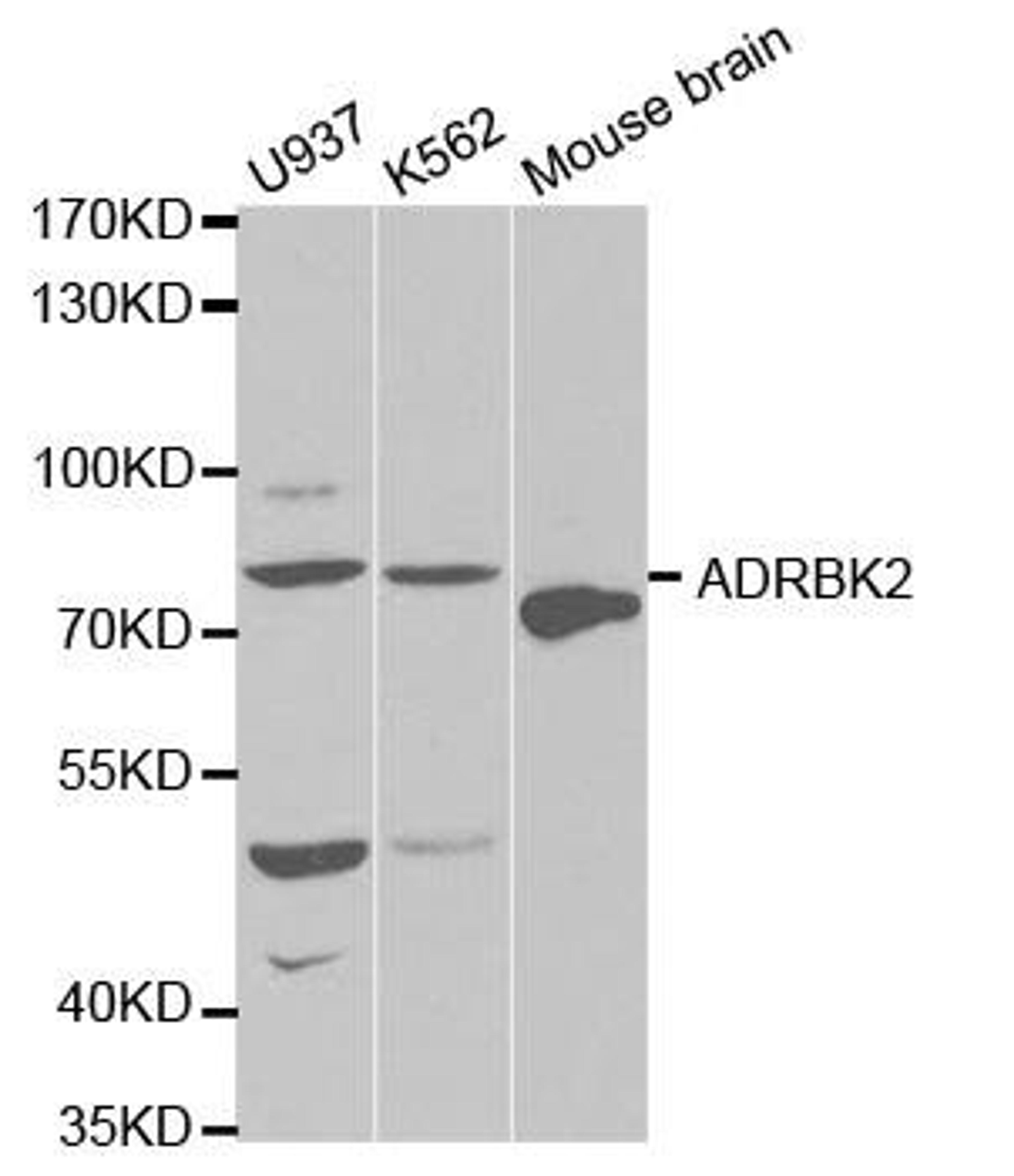 Western blot analysis of extracts of various cell lines using ADRBK2 antibody