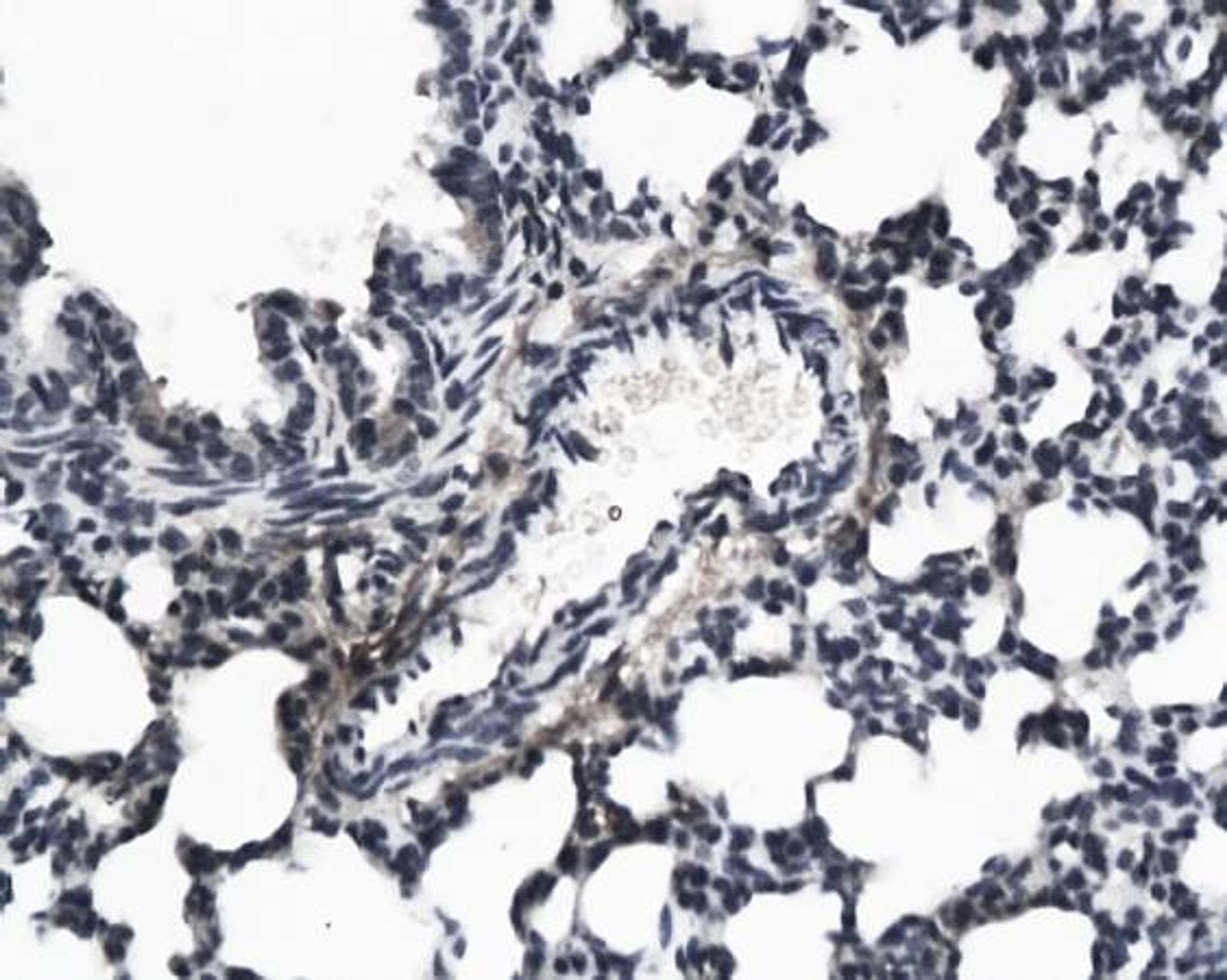 Immunohistochemical analysis of paraffin-embedded rat lung tissue using KGF antibody