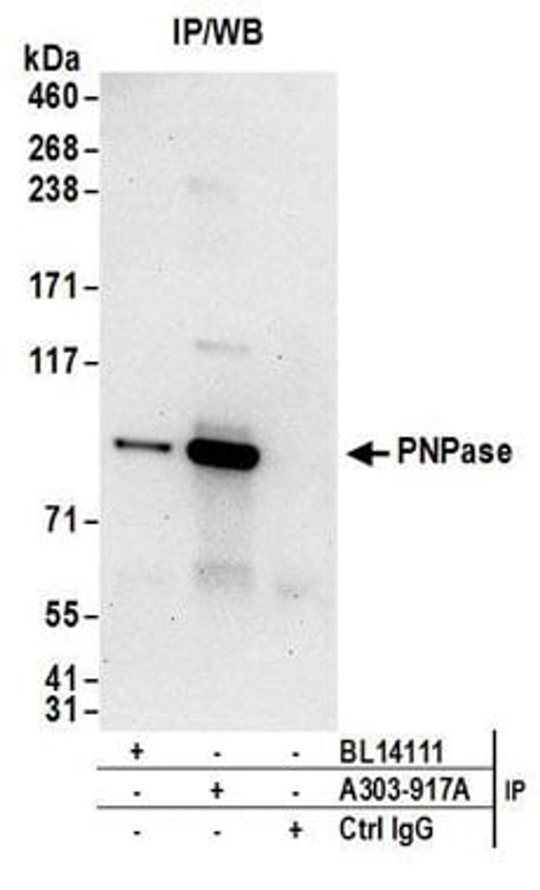 Detection of human PNPase by western blot of immunoprecipitates.