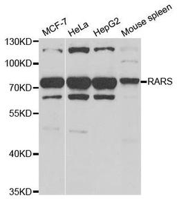 Western blot analysis of extracts of various cell lines using RARS antibody