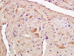 Immunohistochemical staining of rat heart tissue using OPI3K p85 (phospho-Tyr458) antibody