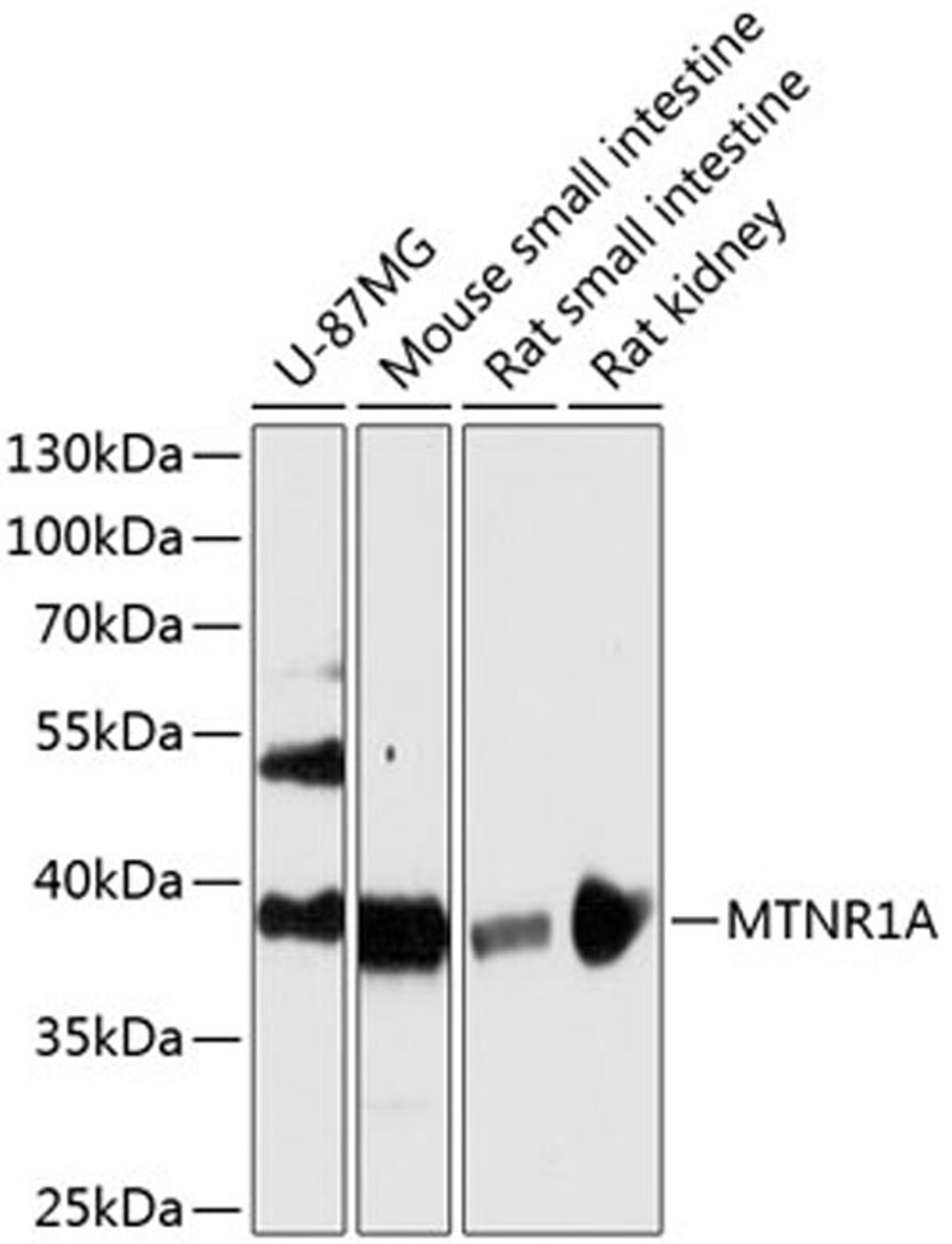 Western blot - MTNR1A antibody (A13030)