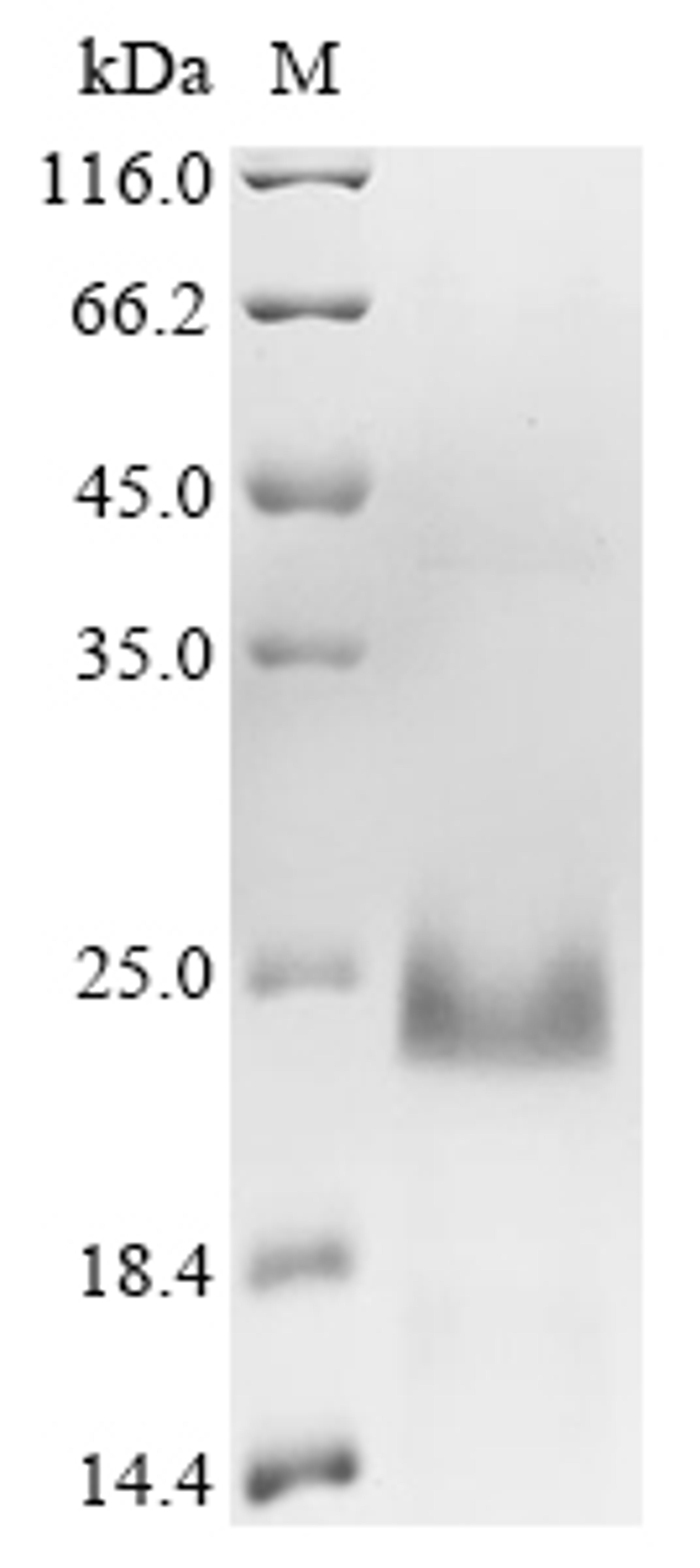(Tris-Glycine gel) Discontinuous SDS-PAGE (reduced) with 5% enrichment gel and 15% separation gel.