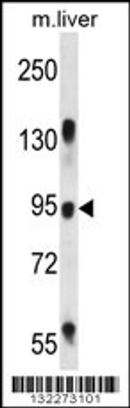 Western blot analysis in mouse liver tissue lysates (35ug/lane).