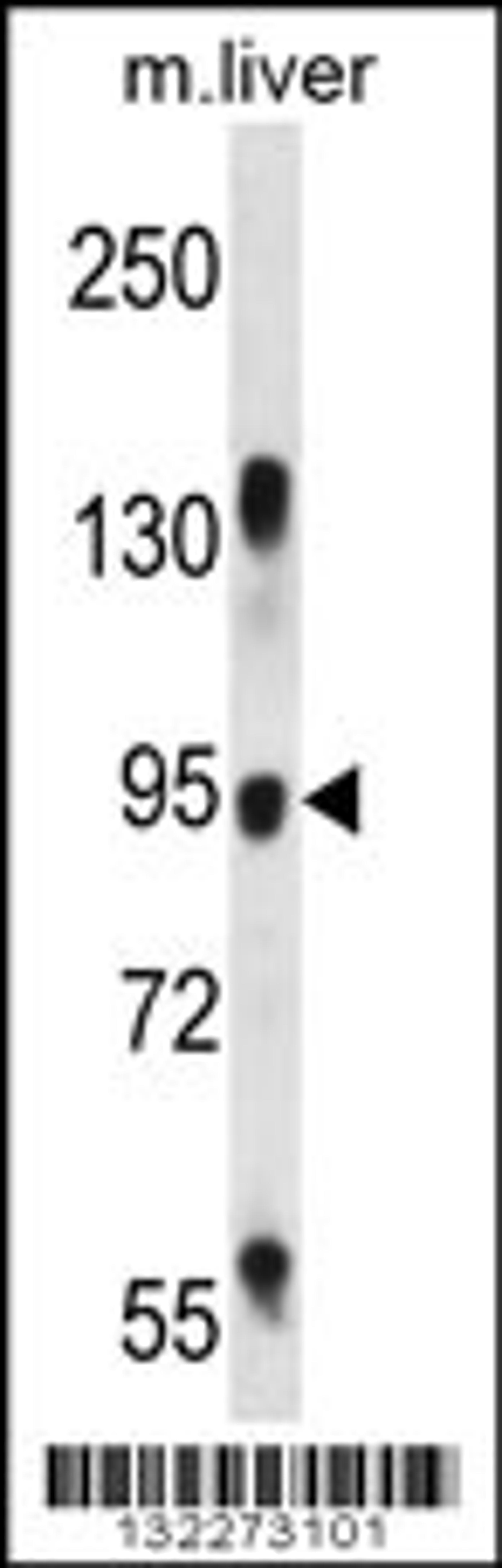 Western blot analysis in mouse liver tissue lysates (35ug/lane).