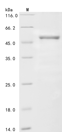 (Tris-Glycine gel) Discontinuous SDS-PAGE (reduced) with 5% enrichment gel and 15% separation gel.