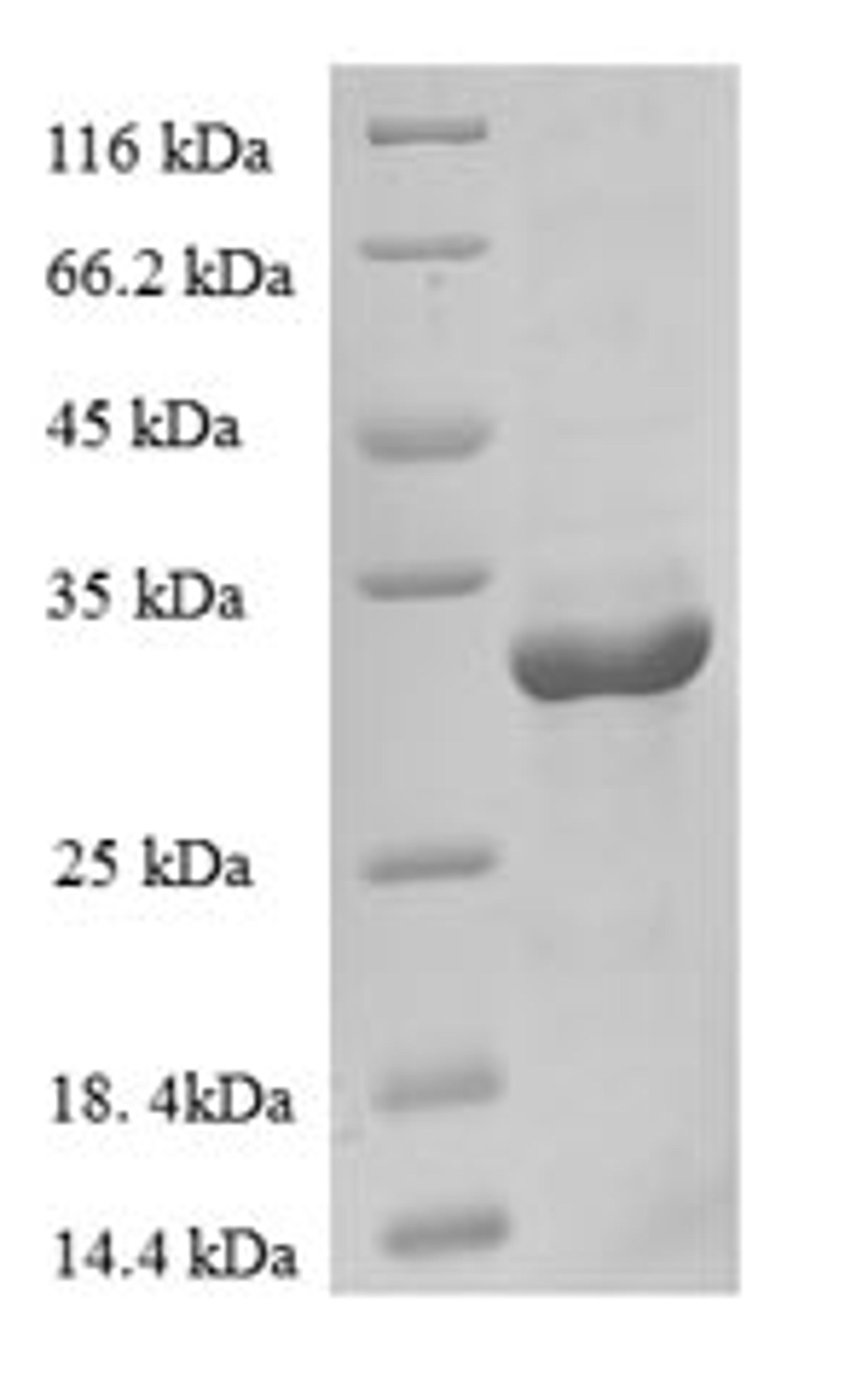 (Tris-Glycine gel) Discontinuous SDS-PAGE (reduced) with 5% enrichment gel and 15% separation gel.