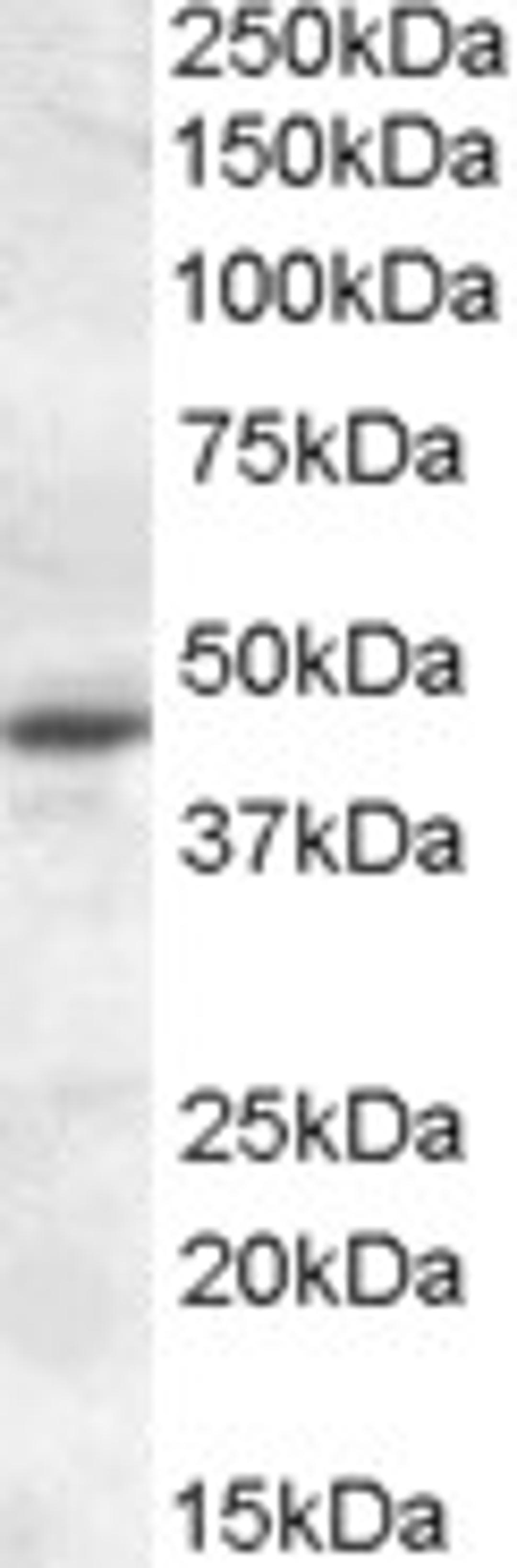 46-987 (0.1ug/ml) staining of Rat Retina lysate (35ug protein in RIPA buffer). Primary incubation was 1 hour. Detected by chemiluminescence.