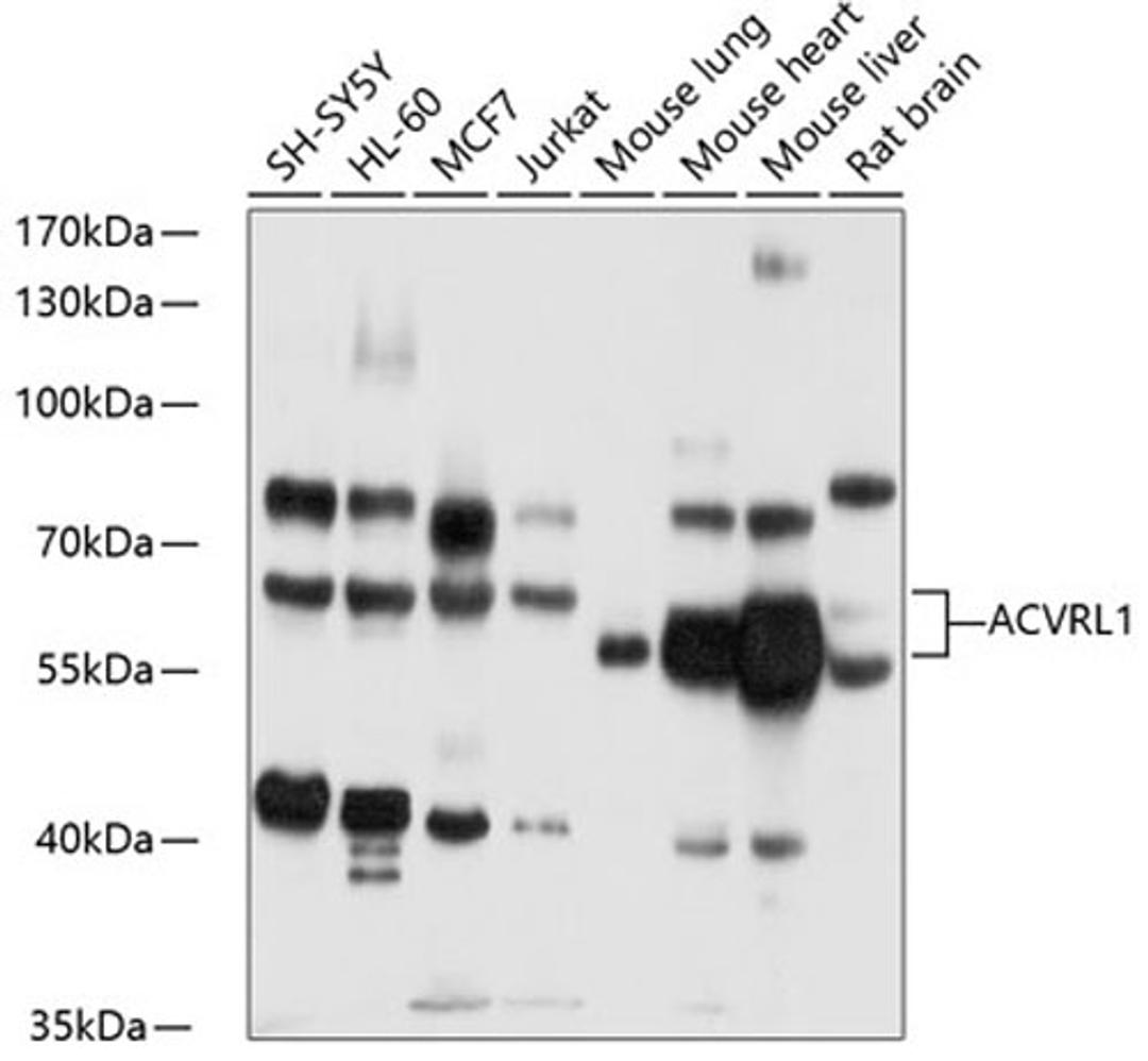 Western blot - ACVRL1 antibody (A1791)