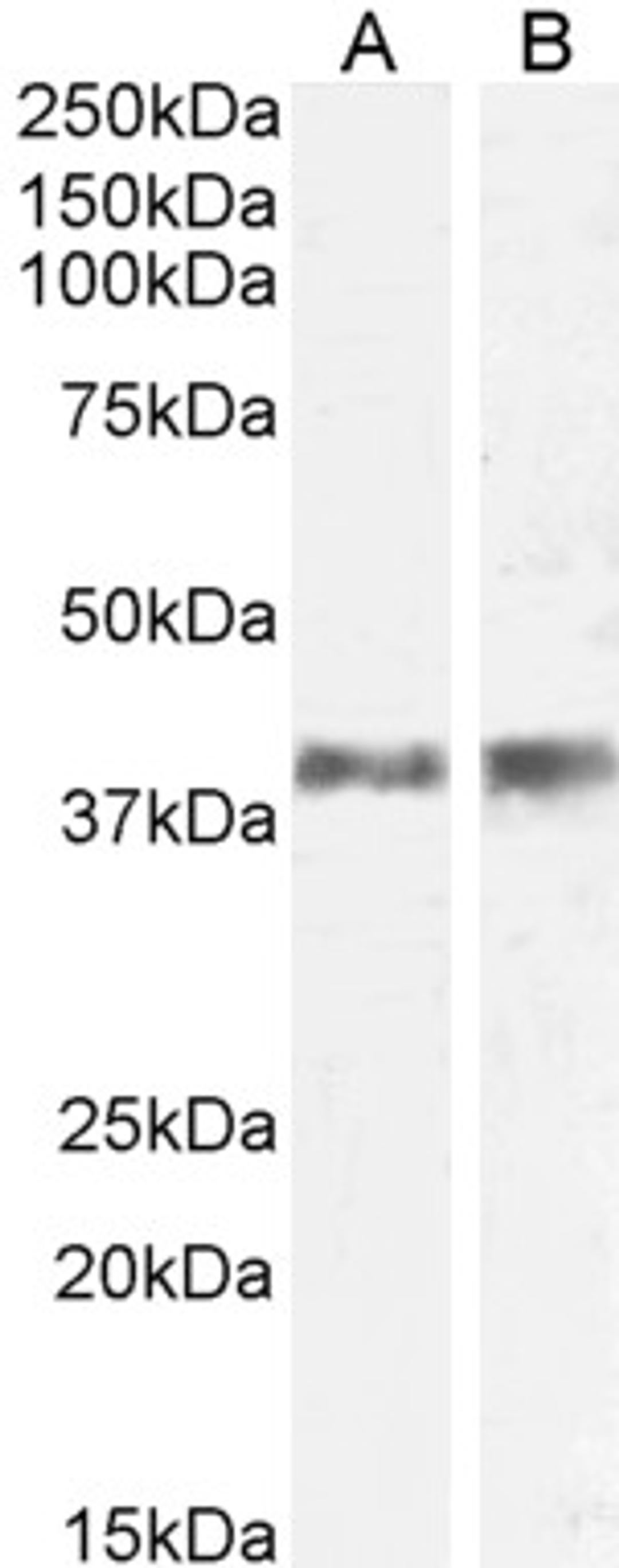 45-766 (0.5ug/ml) staining of Mouse (A) and Rat (B) Skin lysate (35ug protein in RIPA buffer). Primary incubation was 1 hour. Detected by chemiluminescence.