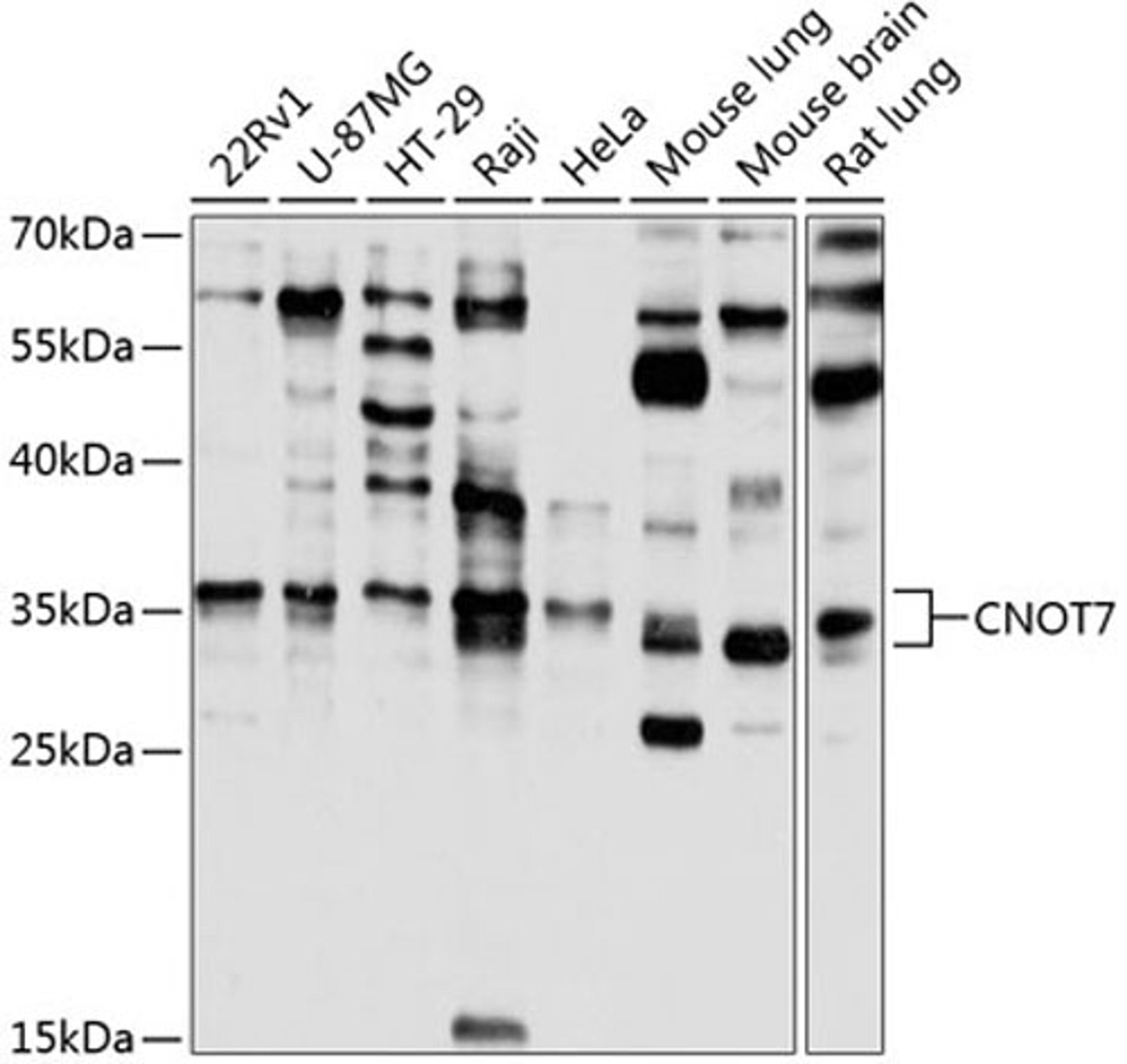 Western blot - CNOT7 antibody (A8959)