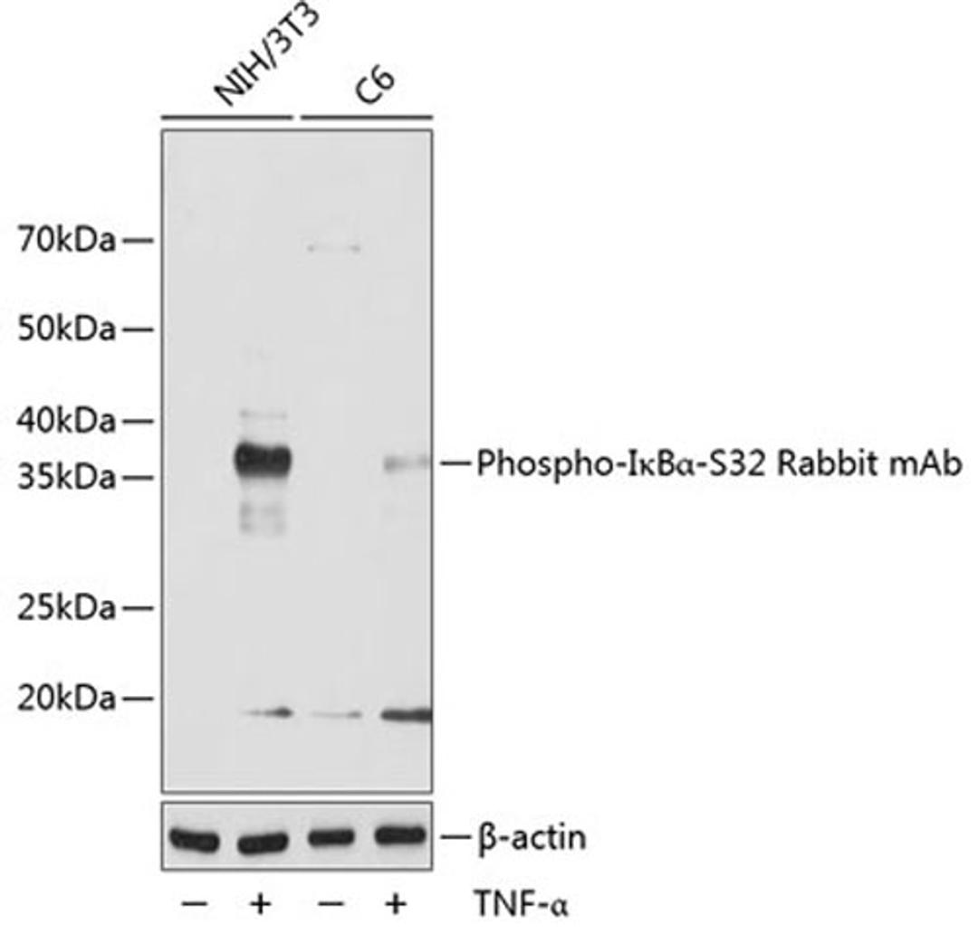 Western blot - Phospho-I?Ba-S32 Rabbit mAb (AP0707)