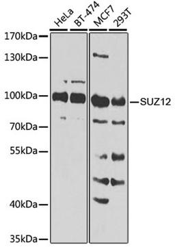 Western blot - SUZ12 Antibody (A7786)