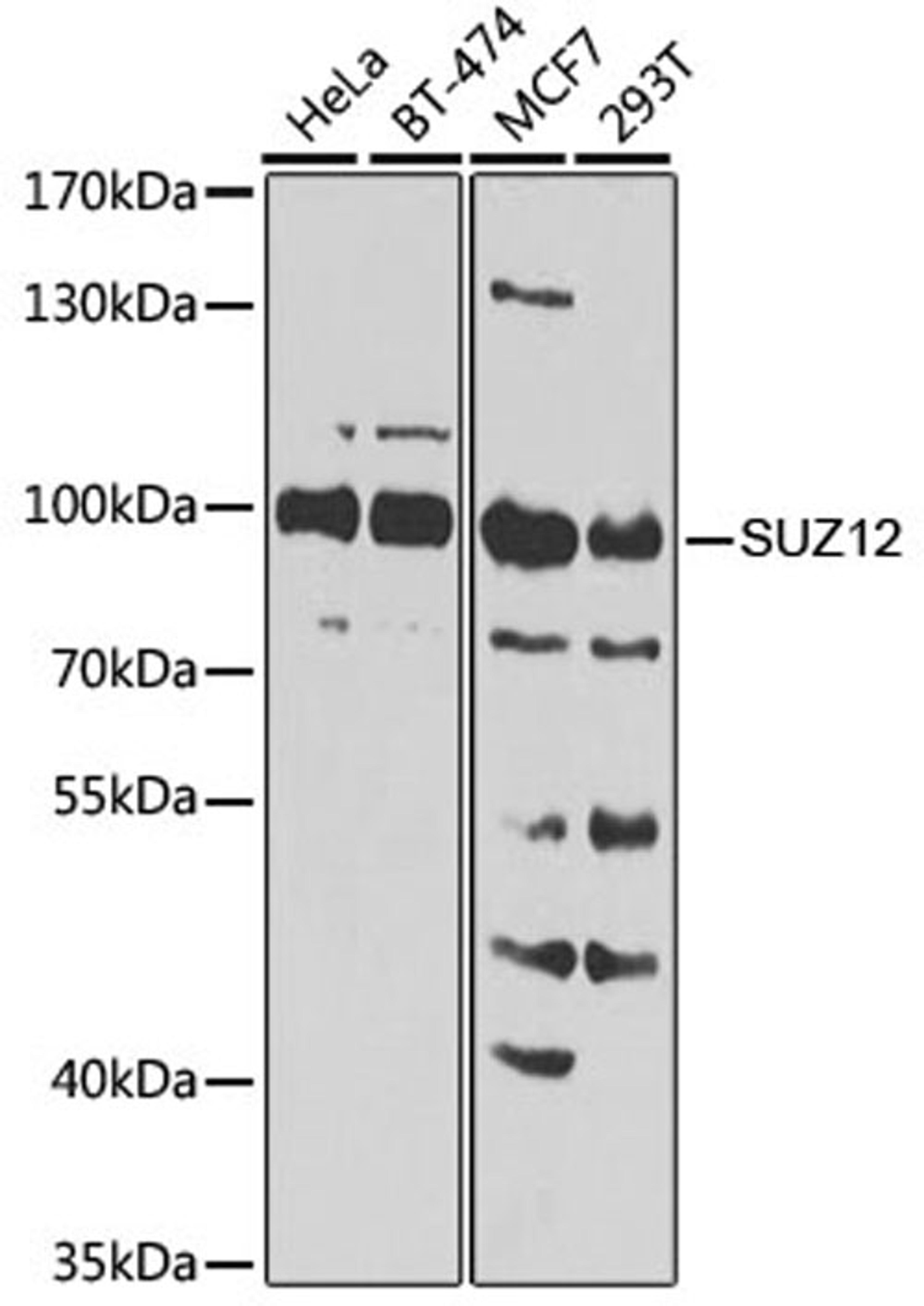 Western blot - SUZ12 Antibody (A7786)