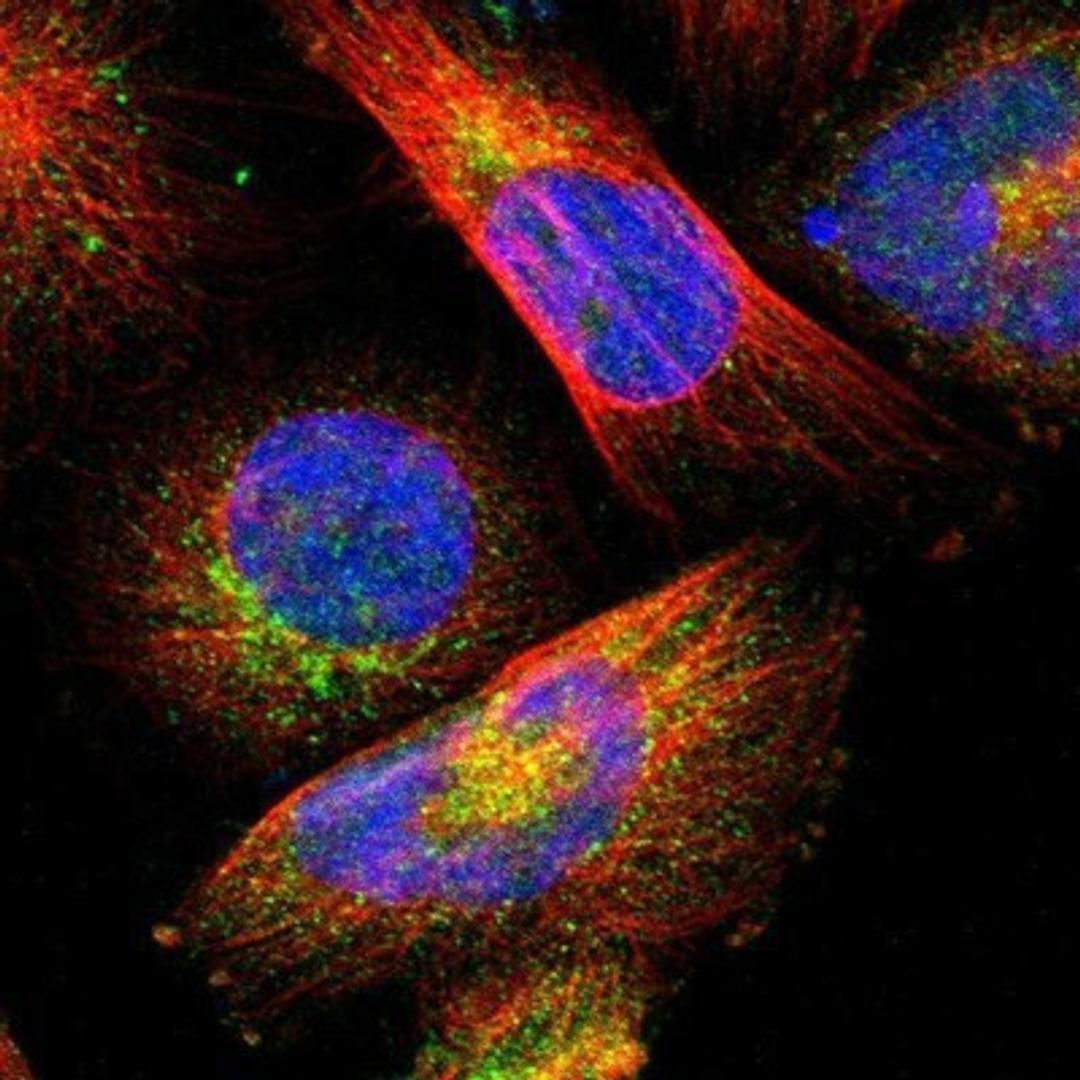 Immunocytochemistry/Immunofluorescence: Acetyl Coenzyme A Carboxylase Beta Antibody [NBP1-90274] - Staining of human cell line U-251 MG shows positivity in cytoplasm.