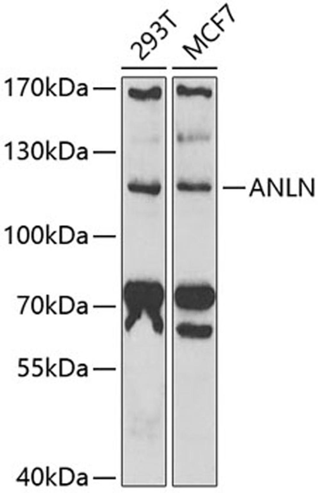 Western blot - ANLN antibody (A6524)