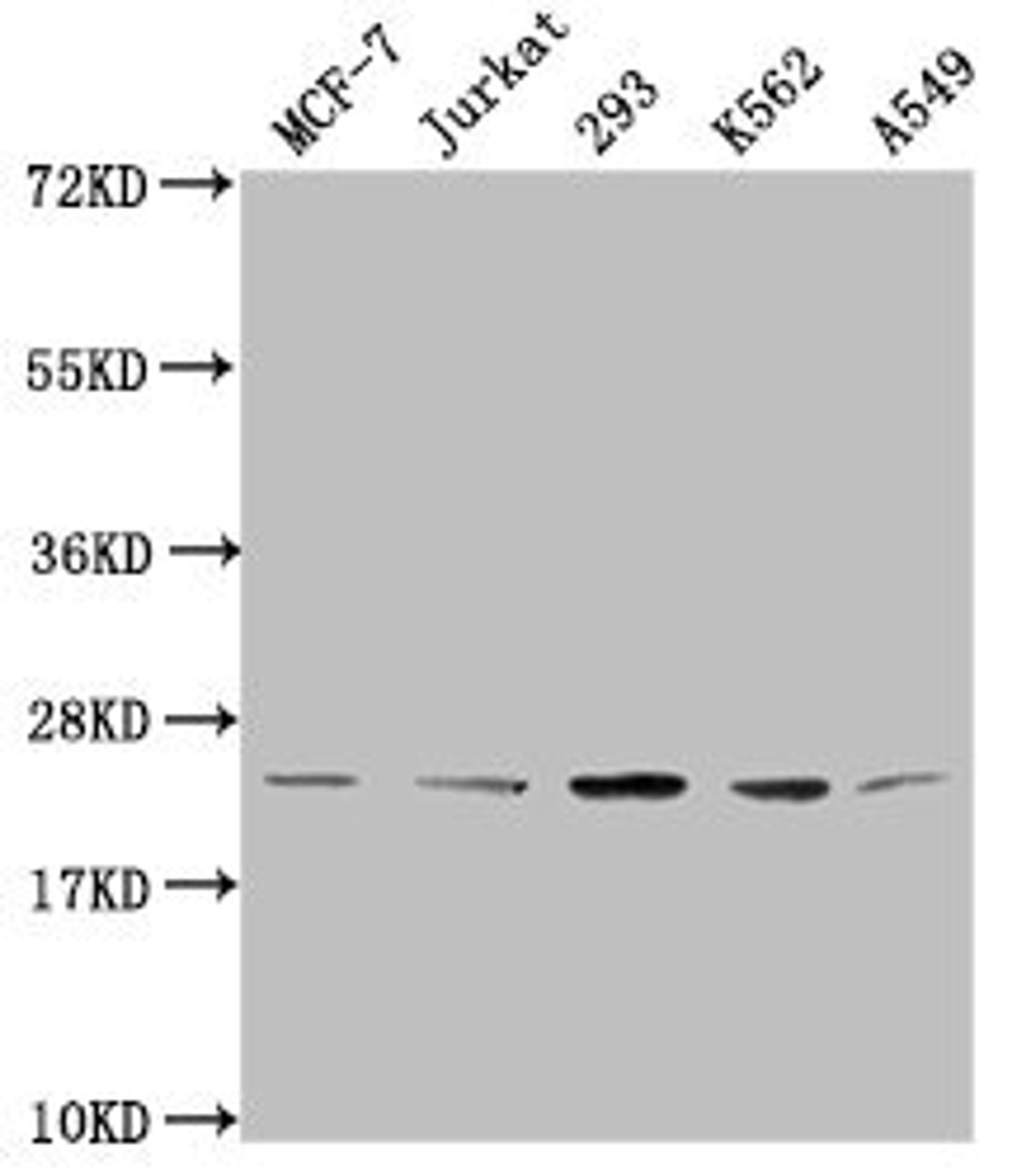 Western Blot. Positive WB detected in: MCF-7 whole cell lysate, Jurkat whole cell lysate, 293 whole cell lysate, K562 whole cell lysate, A549 whole cell lysate. All lanes: HIST1H1C antibody at 1:2000. Secondary. Goat polyclonal to rabbit IgG at 1/40000 dilution. Predicted band size: 22 kDa. Observed band size: 22 kDa