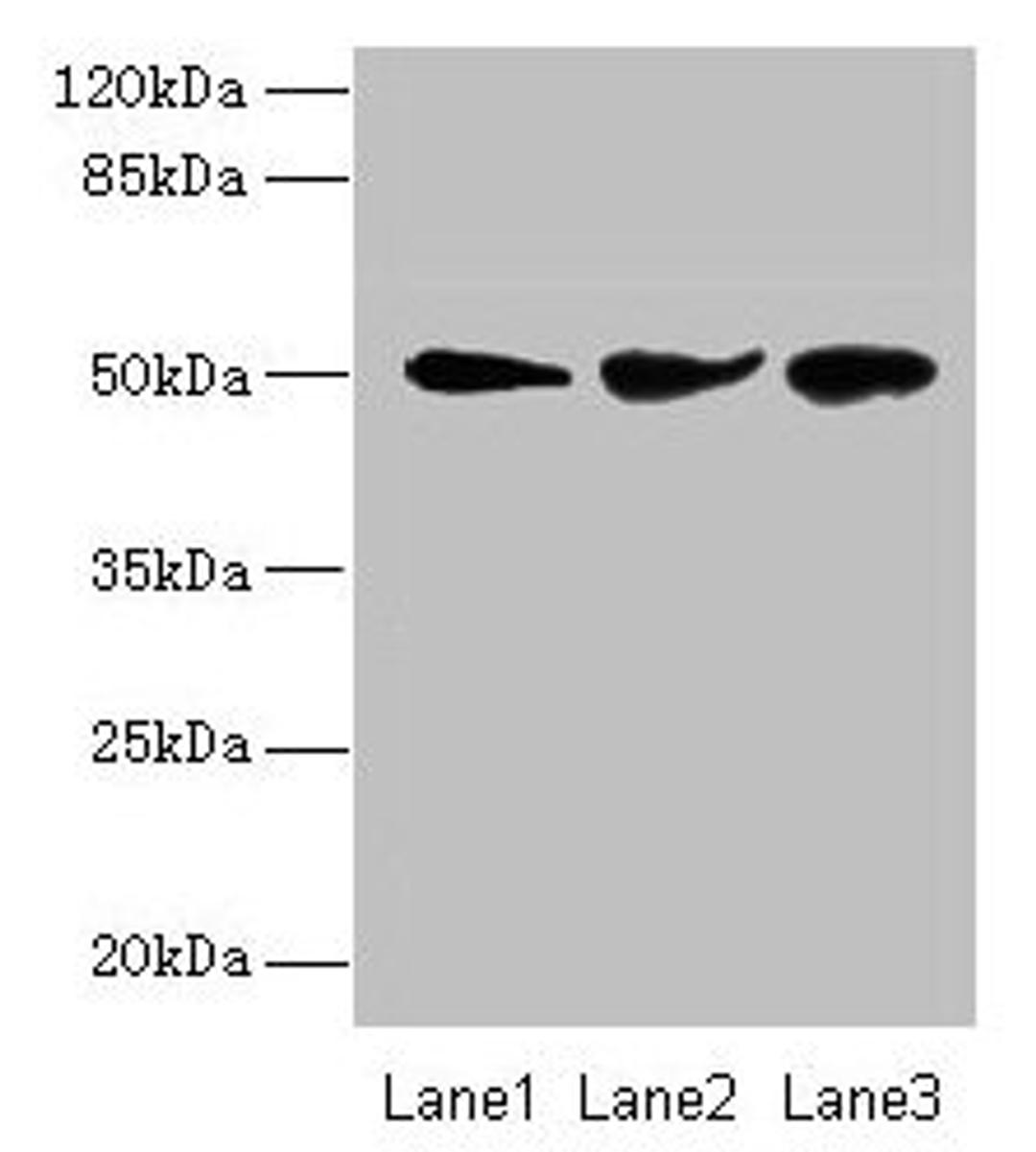 Western blot. All lanes: NIM1K antibody at 2µg/ml. Lane 1: Jurkat whole cell lysate. Lane 2: HepG2 whole cell lysate. Lane 3: COLO205 whole cell lysate. Secondary. Goat polyclonal to rabbit IgG at 1/10000 dilution. Predicted band size: 50 kDa. Observed band size: 50 kDa