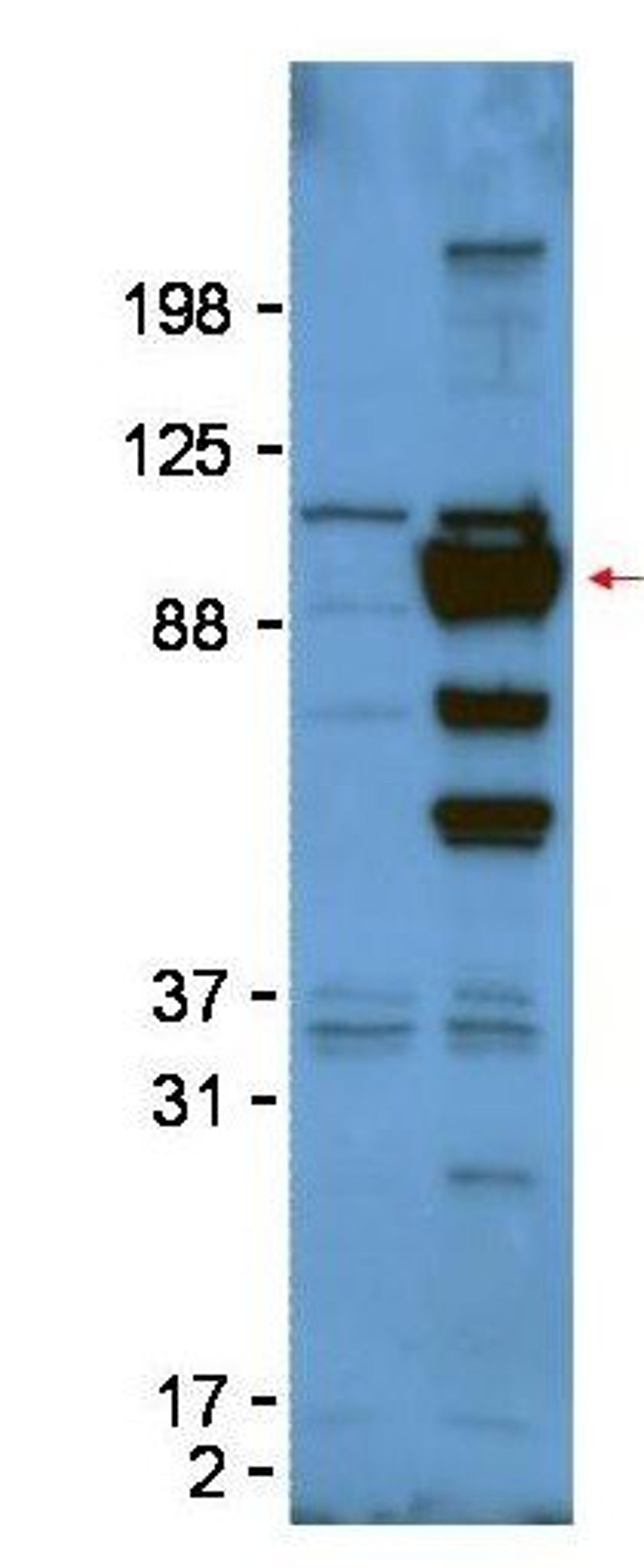 Western blot analysis of Lane 1: untransfected 293T cell lysate. Lane 2: 293T whole cell lysate. Load: 50ug per lane using Glypican-1 antibody