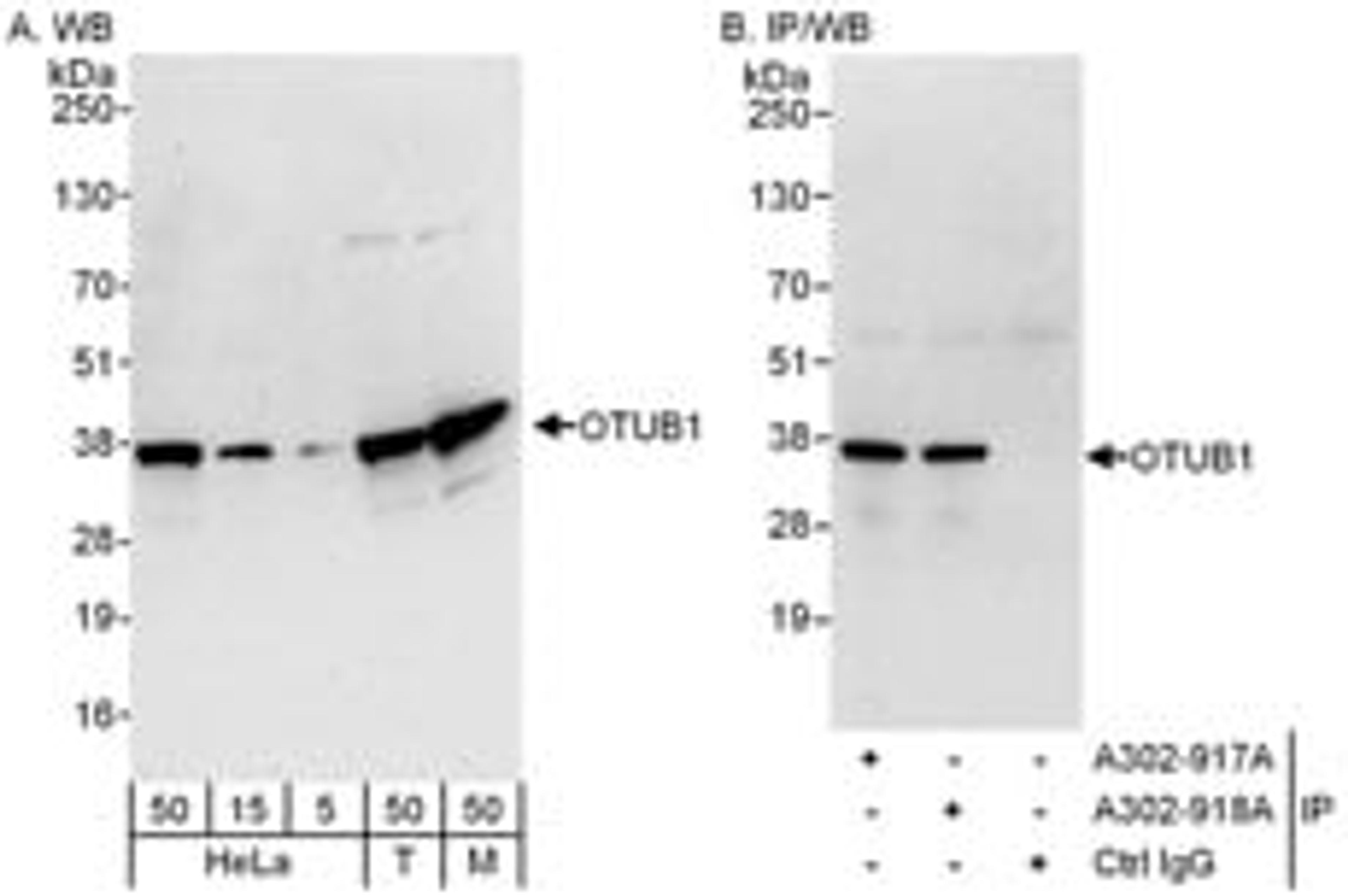 Detection of human and mouse OTUB1 by western blot (h&m) and immunoprecipitation (h).