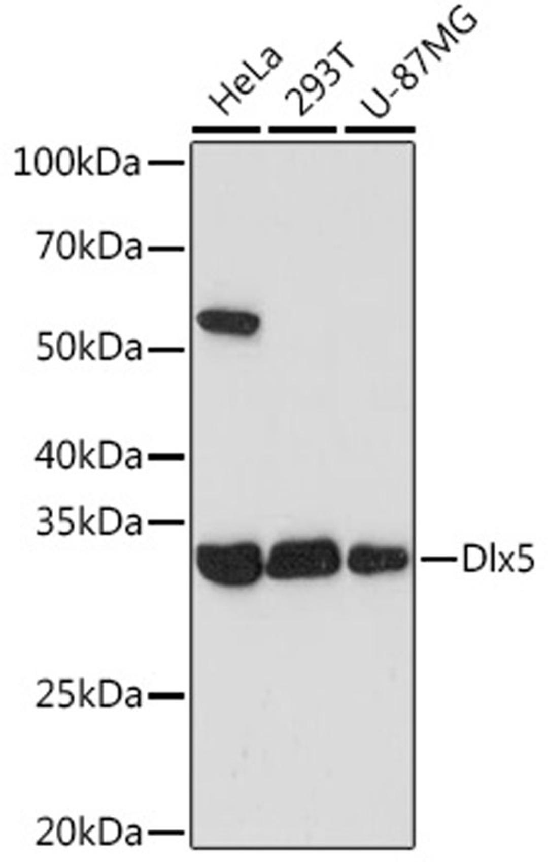 Western blot - Dlx5 Rabbit mAb (A5586)