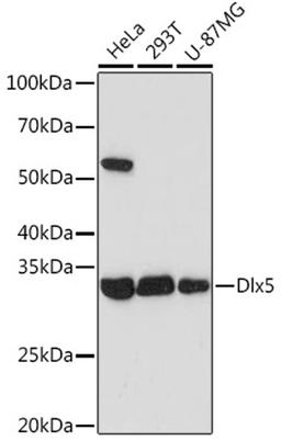 Western blot - Dlx5 Rabbit mAb (A5586)