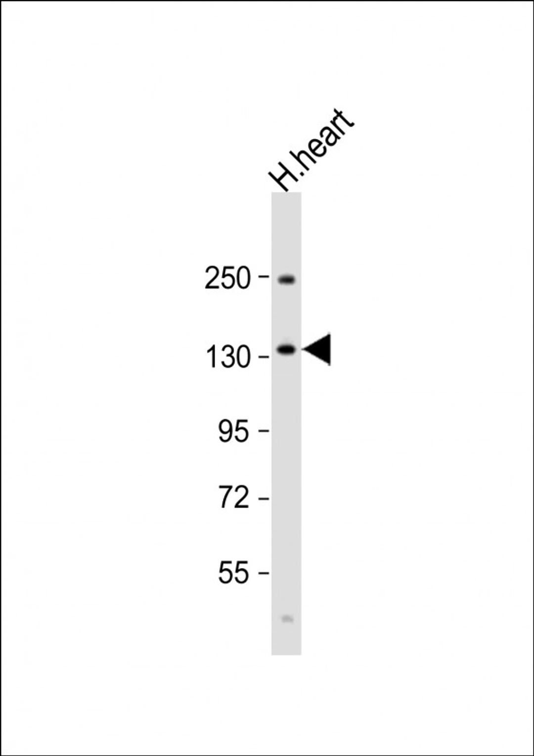 Western Blot at 1:1000 dilution + human heart lysate Lysates/proteins at 20 ug per lane.