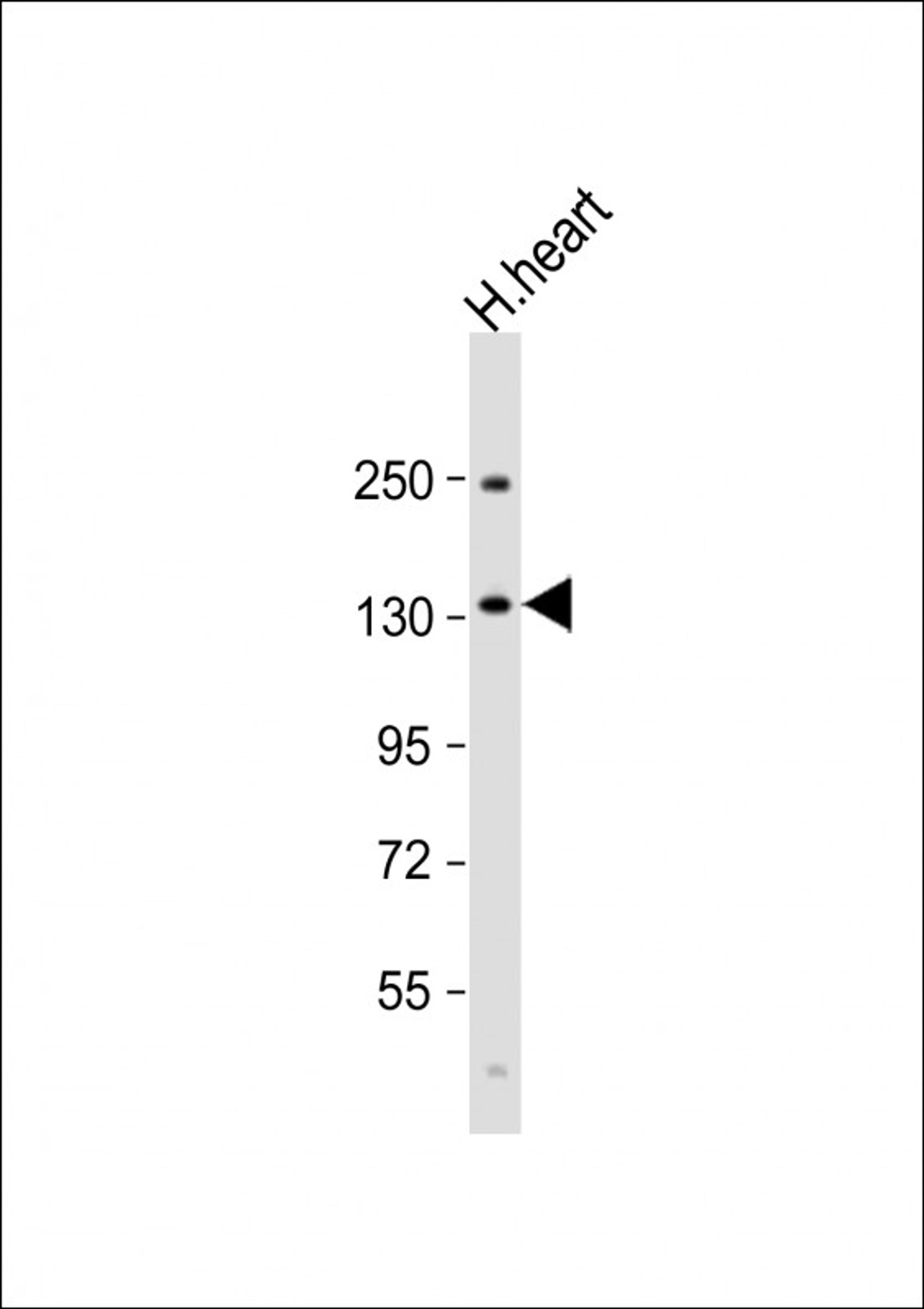 Western Blot at 1:1000 dilution + human heart lysate Lysates/proteins at 20 ug per lane.