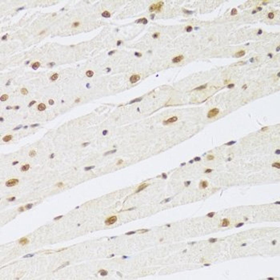 Immunohistochemistry of paraffin-embedded rat heart using MAPK3 antibody