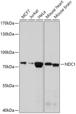 Western blot - NDC1 antibody (A17727)