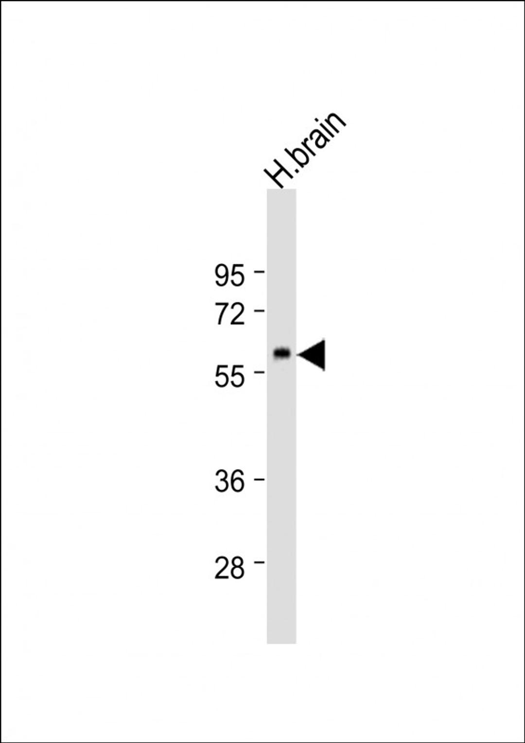 Western Blot at 1:1000 dilution + human brain lysate Lysates/proteins at 20 ug per lane.