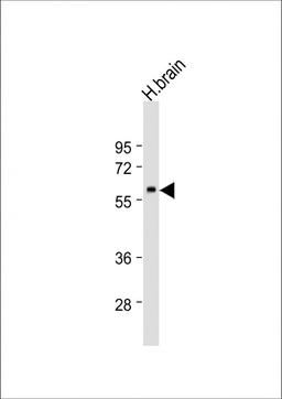 Western Blot at 1:1000 dilution + human brain lysate Lysates/proteins at 20 ug per lane.