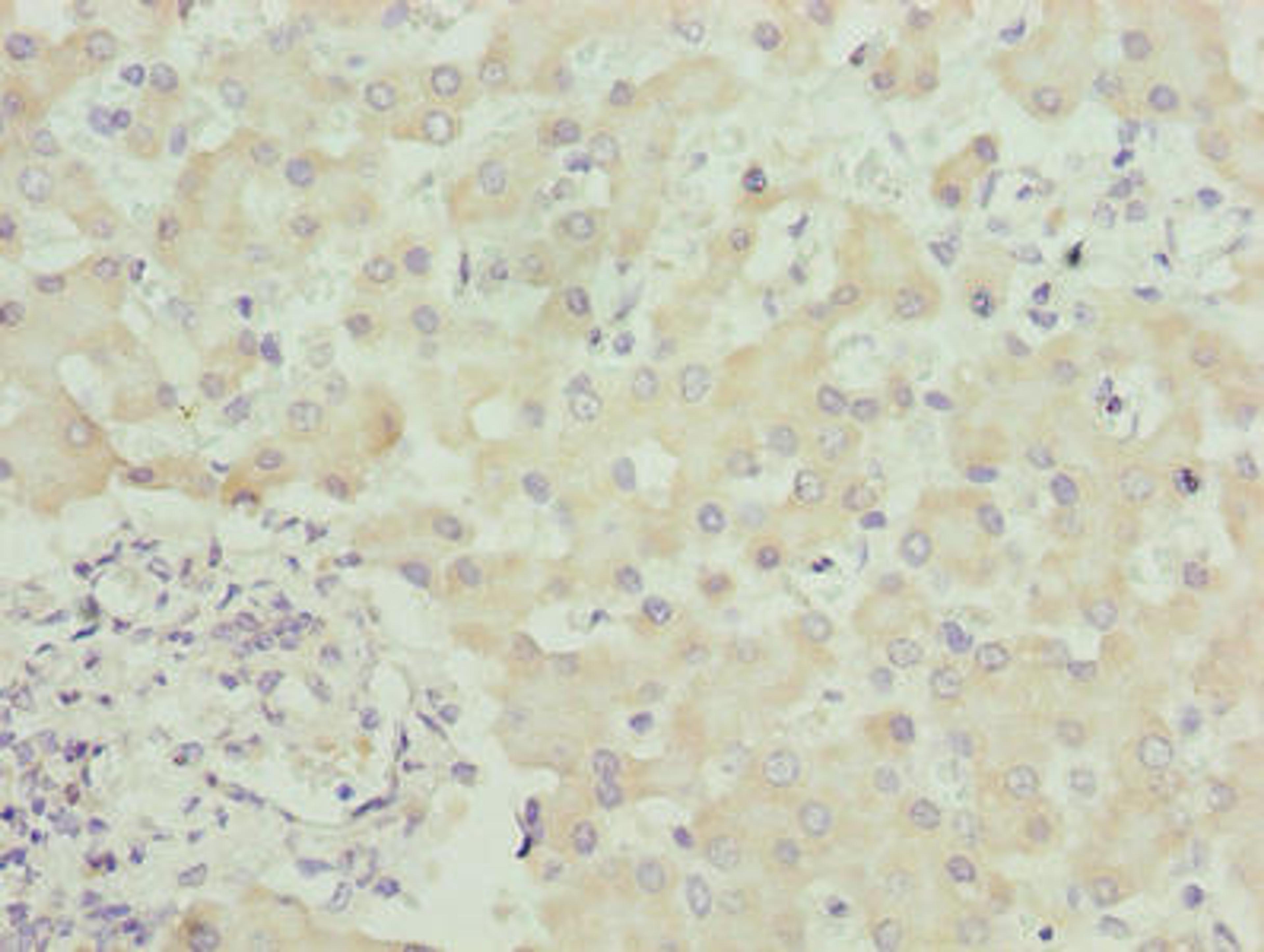 Immunohistochemistry of paraffin-embedded human liver tissue using CSB-PA022517LA01HU at dilution of 1:100