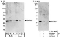 Detection of human REDD1 by western blot and immunoprecipitation.