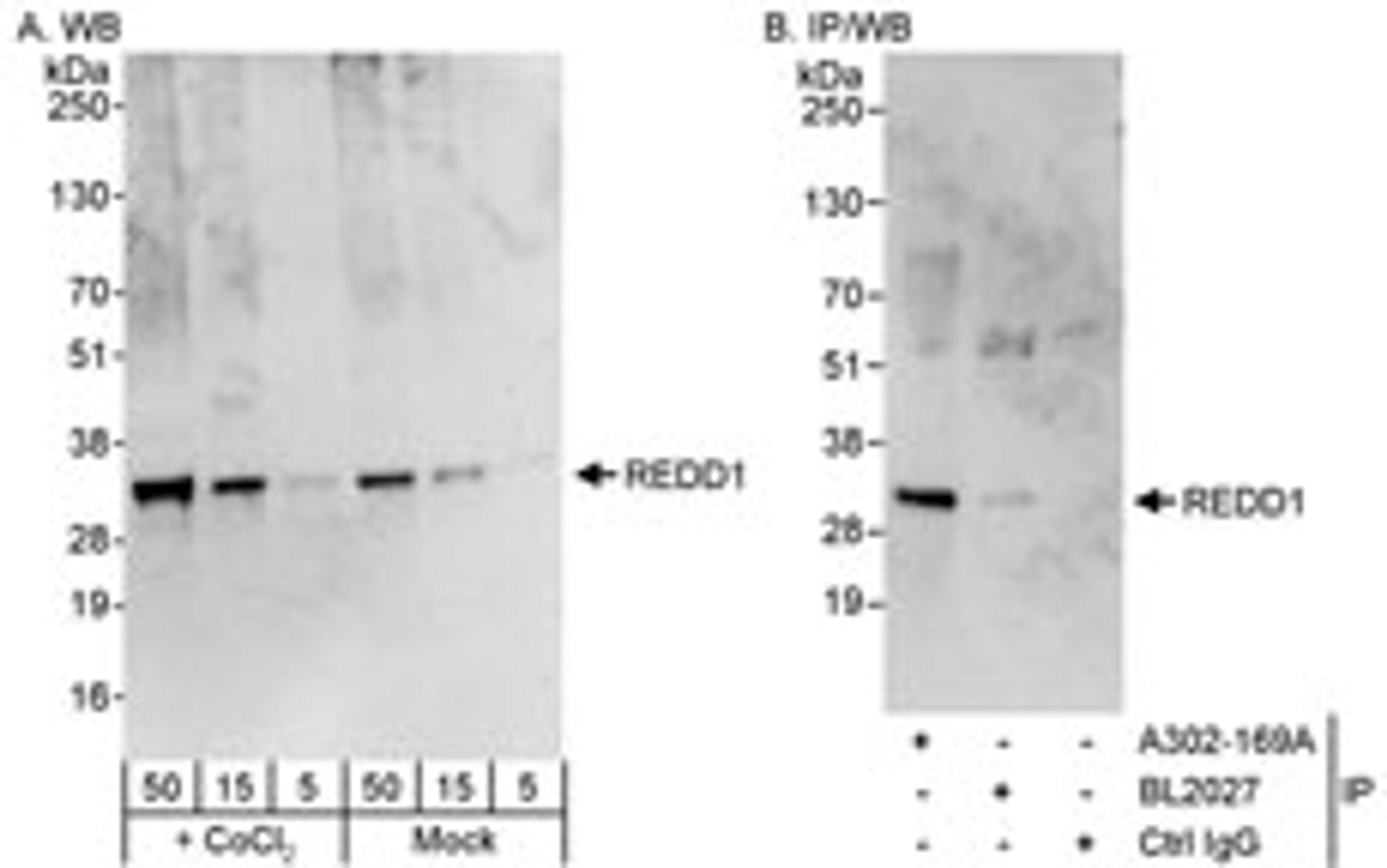 Detection of human REDD1 by western blot and immunoprecipitation.