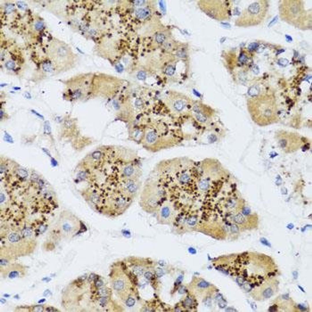 Immunohistochemical staining of human gastric tissue using CHIC2 antibody (dilution of 1:100)