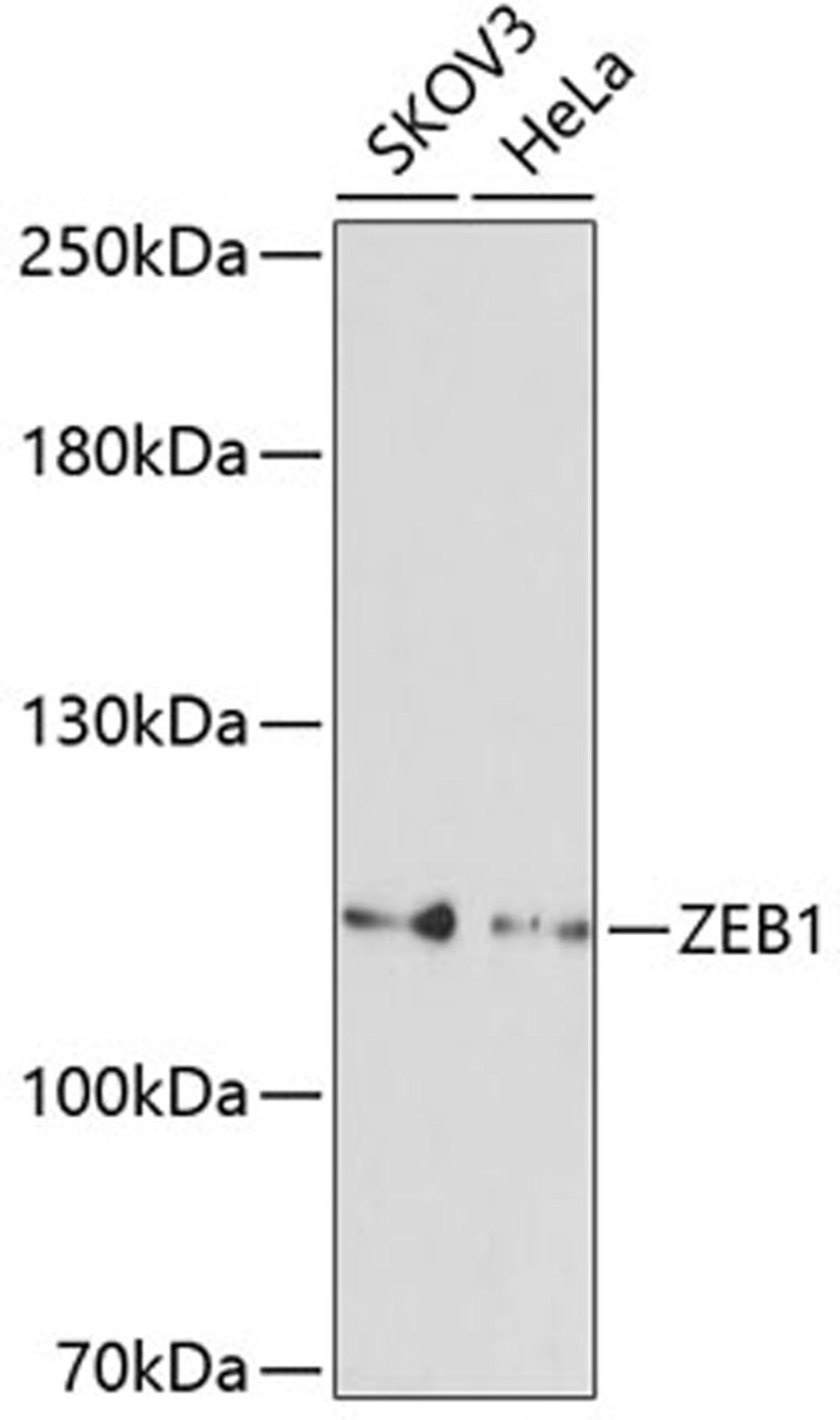 Western blot - ZEB1 antibody (A5600)