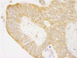 Detection of human cAbl by immunohistochemistry.