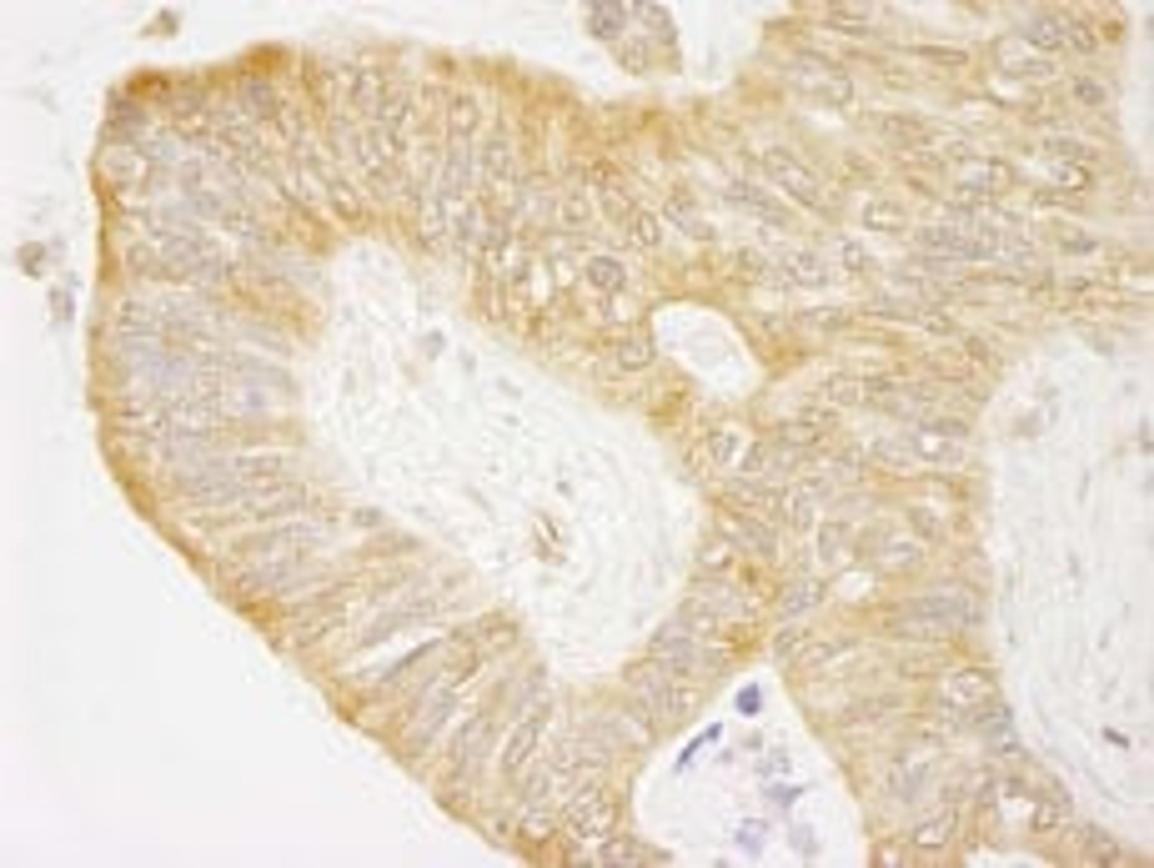 Detection of human cAbl by immunohistochemistry.