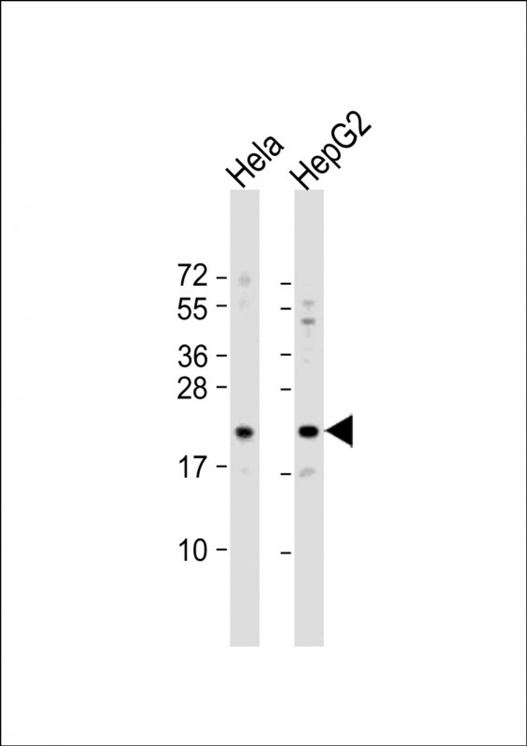 Western Blot at 1:1000 dilution Lane 1: Hela whole cell lysate Lane 2: HepG2 whole cell lysate Lysates/proteins at 20 ug per lane.