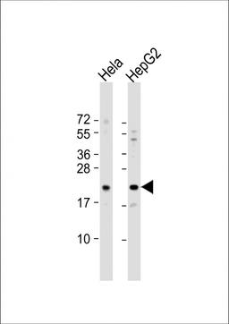 Western Blot at 1:1000 dilution Lane 1: Hela whole cell lysate Lane 2: HepG2 whole cell lysate Lysates/proteins at 20 ug per lane.