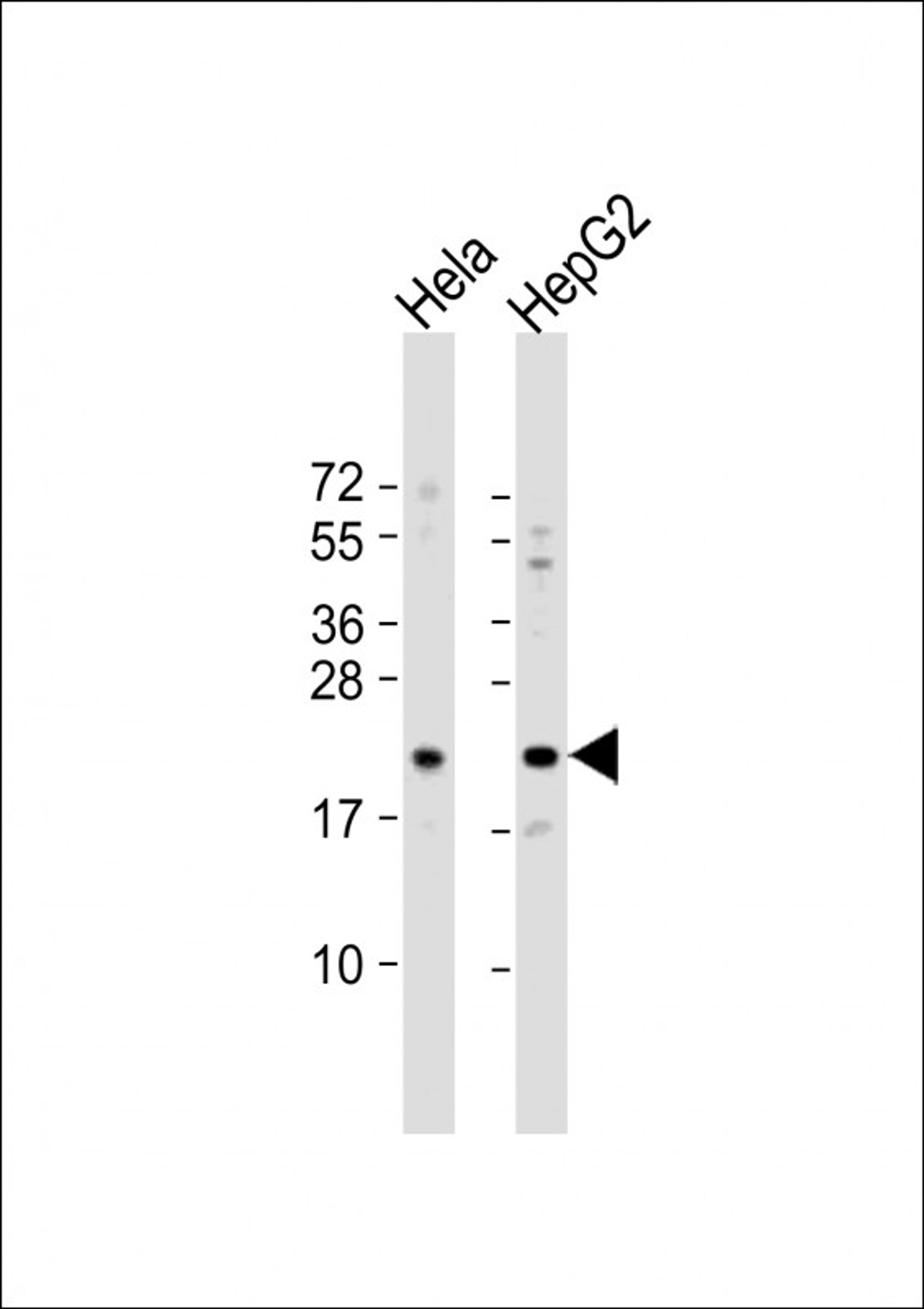 Western Blot at 1:1000 dilution Lane 1: Hela whole cell lysate Lane 2: HepG2 whole cell lysate Lysates/proteins at 20 ug per lane.