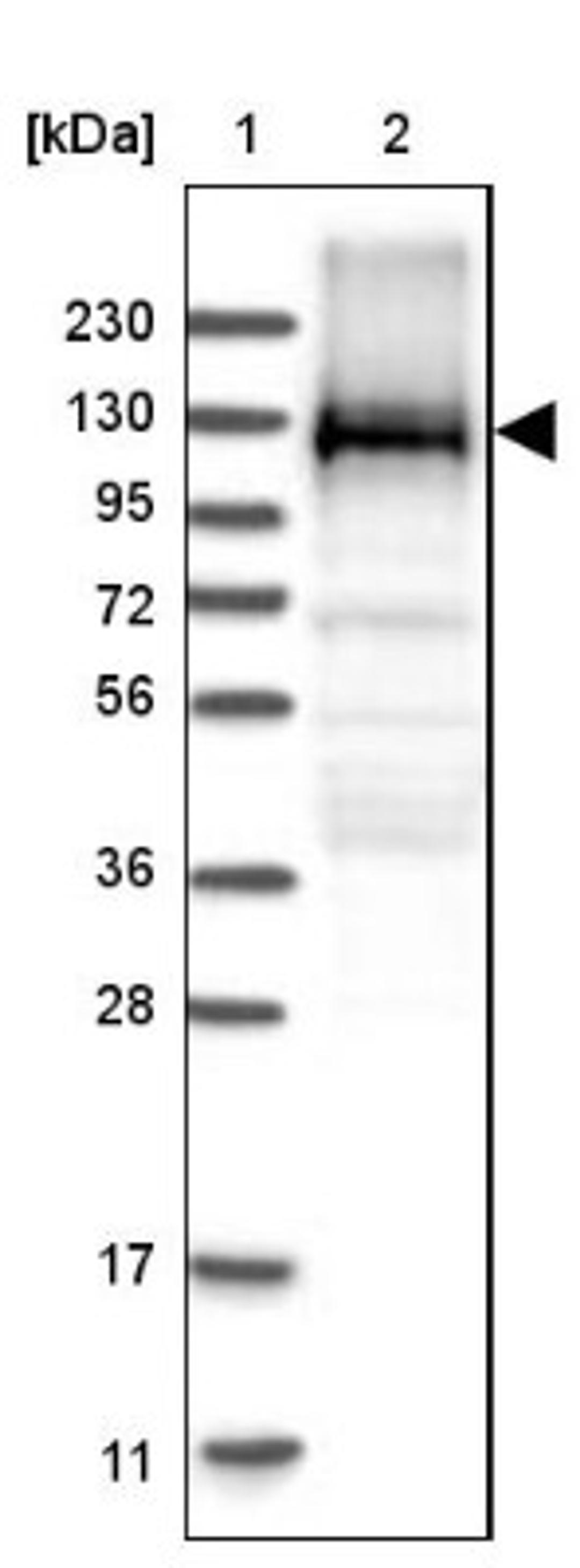 Western Blot: EML4 Antibody [NBP1-86805] - Lane 1: Marker [kDa] 230, 130, 95, 72, 56, 36, 28, 17, 11<br/>Lane 2: Human cell line RT-4