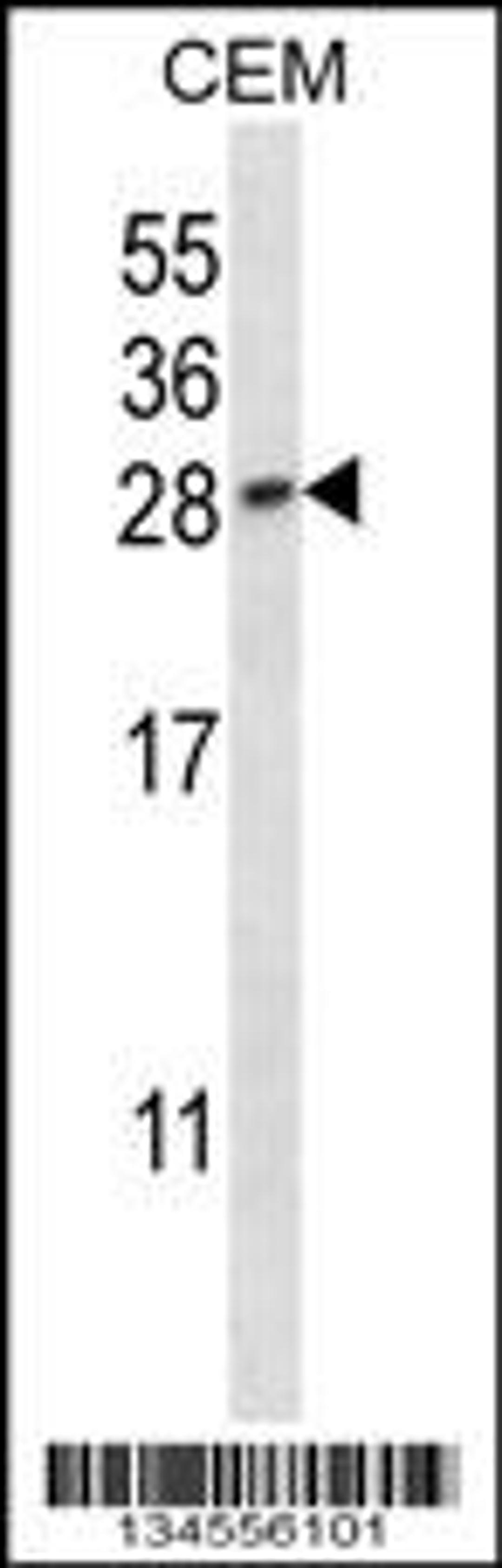 Western blot analysis in CEM cell line lysates (35ug/lane).