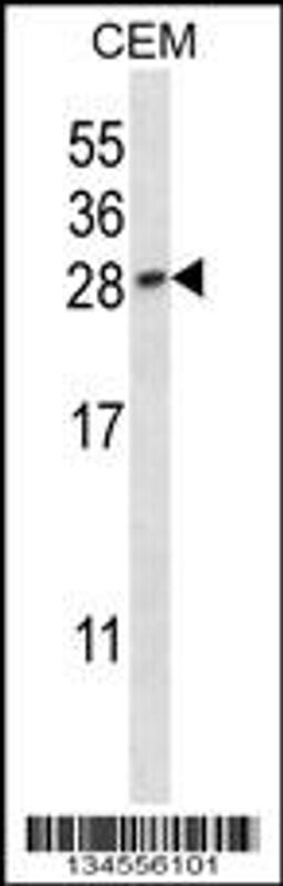 Western blot analysis in CEM cell line lysates (35ug/lane).